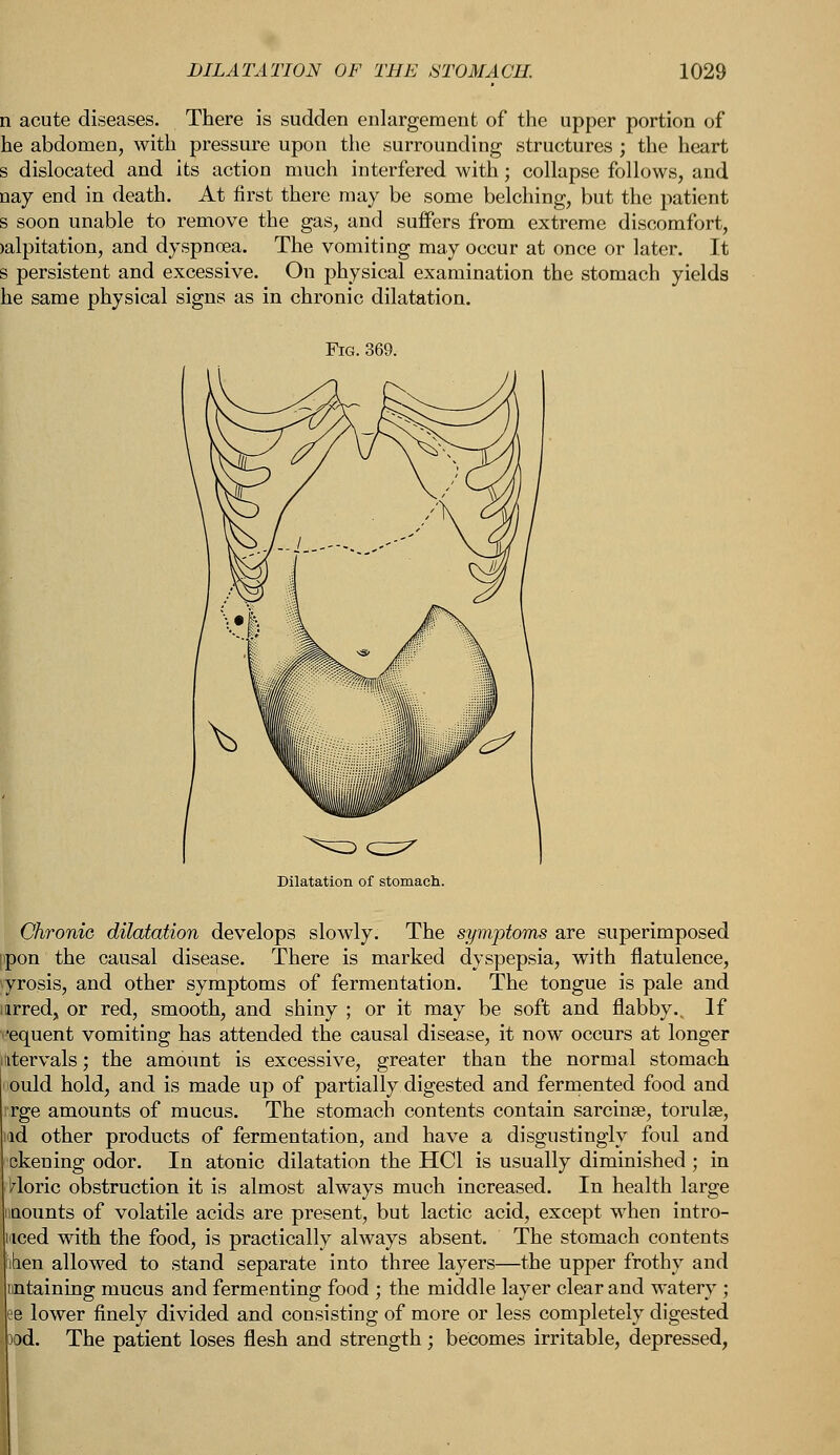 n acute diseases. There is sudden enlargement of the upper portion of he abdomen, with pressure upon the surrounding structures ; the heart s dislocated and its action much interfered with; collapse follows, and nay end in death. At first there may be some belching, but the patient s soon unable to remove the gas, and suffers from extreme discomfort, >alpitation, and dyspnoea. The vomiting may occur at once or later. It s persistent and excessive. On physical examination the stomach yields he same physical signs as in chronic dilatation. Fig. Dilatation of stomach. Chronic dilatation develops slowly. The symptoms are superimposed pon the causal disease. There is marked dyspepsia, with flatulence, yrosis, and other symptoms of fermentation. The tongue is pale and irred, or red, smooth, and shiny ; or it may be soft and flabby., If •equent vomiting has attended the causal disease, it now occurs at longer intervals; the amount is excessive, greater than the normal stomach ould hold, and is made up of partially digested and fermented food and rge amounts of mucus. The stomach contents contain sarcinae, torulse, ad other products of fermentation, and have a disgustingly foul and ckening odor. In atonic dilatation the HC1 is usually diminished ; in zloric obstruction it is almost always much increased. In health large nounts of volatile acids are present, but lactic acid, except when intro- iced with the food, is practically always absent. The stomach contents aen allowed to stand separate into three layers—the upper frothy and ntaining mucus and fermenting food ; the middle layer clear and watery ; e lower finely divided and consisting of more or less completely digested iod. The patient loses flesh and strength; becomes irritable, depressed,