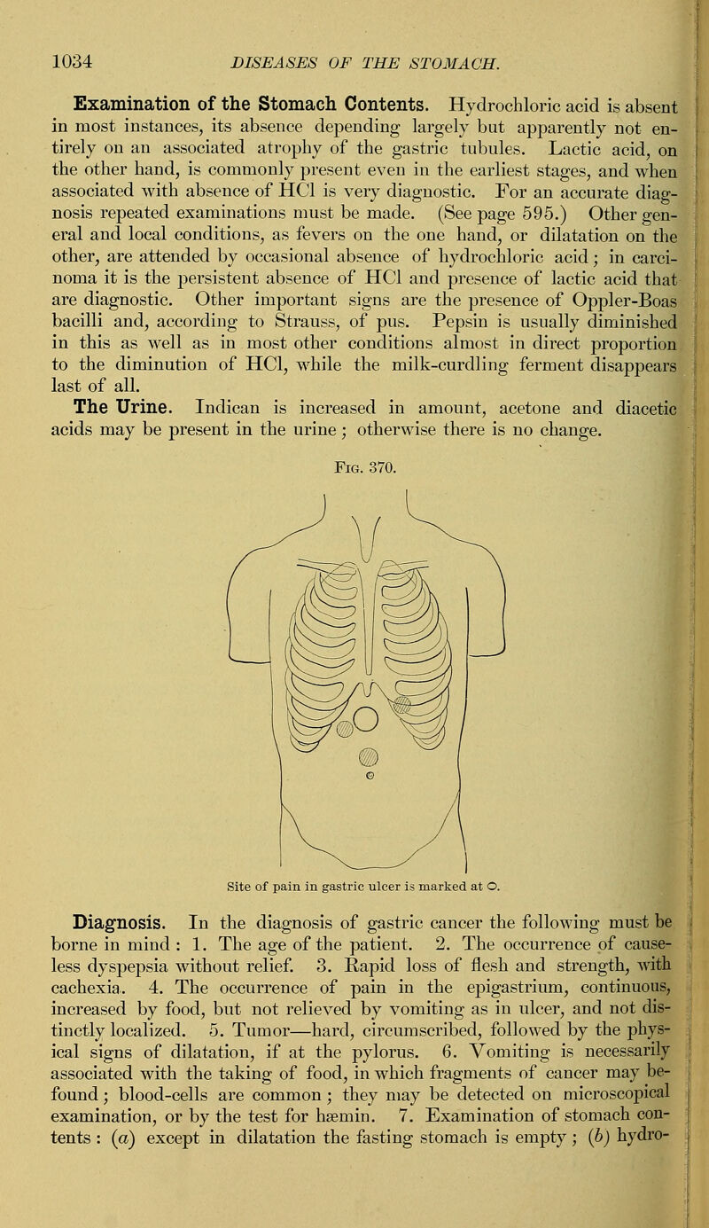 Examination of the Stomach Contents. Hydrochloric acid is absent in most instances, its absence depending largely but apparently not en- tirely on an associated atrophy of the gastric tubules. Lactic acid, on the other hand, is commonly present even in the earliest stages, and when associated with absence of HC1 is very diagnostic. For an accurate diag- nosis repeated examinations must be made. (See page 595.) Other gen- eral and local conditions, as fevers on the one hand, or dilatation on the other, are attended by occasional absence of hydrochloric acid; in carci- noma it is the persistent absence of HC1 and presence of lactic acid that are diagnostic. Other important signs are the presence of Oppler-Boas bacilli and, according to Strauss, of pus. Pepsin is usually diminished in this as well as in most other conditions almost in direct proportion to the diminution of HC1, while the milk-curdling ferment disappears last of all. The Urine. Indican is increased in amount, acetone and diacetic acids may be present in the urine; otherwise there is no change. Fig. 370. Site of pain in gastric ulcer is marked at O. Diagnosis. In the diagnosis of gastric cancer the following must be borne in mind : 1. The age of the patient. 2. The occurrence of cause- less dyspepsia without relief. 3. Rapid loss of flesh and strength, with cachexia,. 4. The occurrence of pain in the epigastrium, continuous, increased by food, but not relieved by vomiting as in ulcer, and not dis- tinctly localized. 5. Tumor—hard, circumscribed, followed by the phys- ical signs of dilatation, if at the pylorus. 6. Vomiting is necessarily associated with the taking of food, in which fragments of cancer may be- found; blood-cells are common ; they may be detected on microscopical examination, or by the test for hseniin. 7. Examination of stomach con- tents : (a) except in dilatation the fasting stomach is empty; (b) hydro-