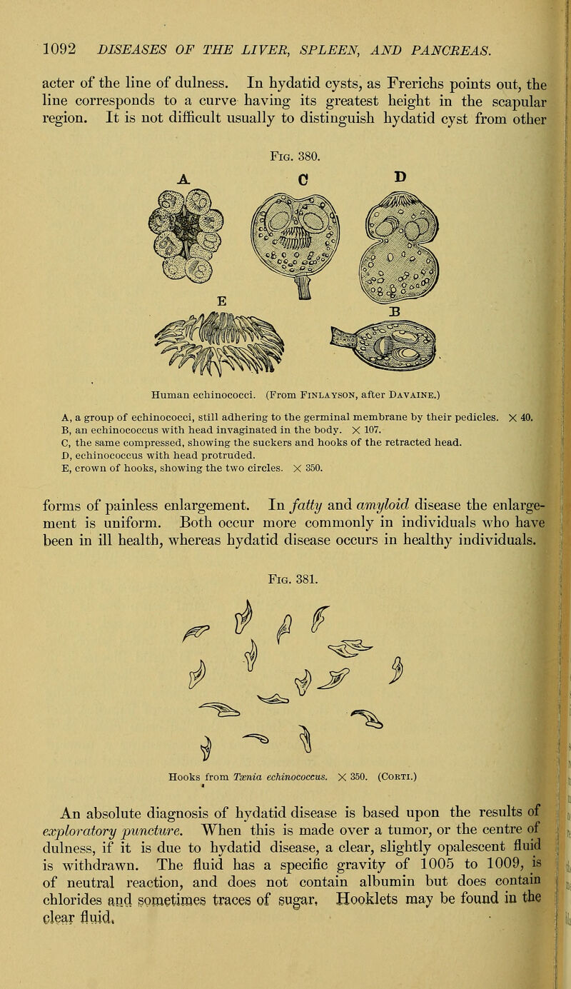 acter of the line of dulness. In hydatid cysts, as Frerichs points out, the line corresponds to a curve having its greatest height in the scapular region. It is not difficult usually to distinguish hydatid cyst from other Human echinoeocci. (From Finlayson, after Davaine.) A, a group of echinoeocci, still adhering to the germinal memhrane by their pedicles. X 40. B, an echinococcus with head invaginated in the body. X 107. C, the same compressed, showing the suckers and hooks of the retracted head. D, echinococcus with head protruded. E, crown of hooks, showing the two circles. X 350. forms of painless enlargement. In fatty and amyloid disease the enlarge- ment is uniform. Both occur more commonly in individuals who have been in ill health, whereas hydatid disease occurs in healthy individuals. <*©- ^ Hooks from Tsenia echinococcus. X 350. (Corti.) An absolute diagnosis of hydatid disease is based upon the results of exploratory puncture. When this is made over a tumor, or the centre of dulness, if it is due to hydatid disease, a clear, slightly opalescent fluid is withdrawn. The fluid has a specific gravity of 1005 to 1009, is of neutral reaction, and does not contain albumin but does contain chlorides and sometimes traces of sugar, Booklets may be found in the dear fluids