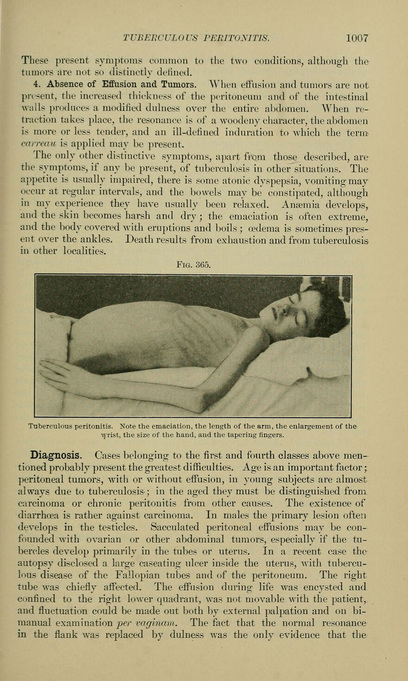These present sym])t()nis common to the two conditions, althongh the tumors are not so ^li^rinctly ilciincil. 4. Absence of Effusion and Tumors, AMicn eifiision and tumors are not present, the increased thit-kncss of the peritoneum and of the intestinal walls produces a modified duhiess over the entire abdomen. When re- traction takes place, tiie resonance is of a woodeny character, the abdomen is more or less tender, and an ill-detiued induration to which the term carreau is applied may be present. The only other distinctive symptoms, apart from those descril)ed, are the symptoms, if any be present, of tuberculosis iu other situations. The appetite is usually impaired, there is some atonic dyspepsia, vomiting may occur at regular intervals, and the bowels may be constipated, although in my experience they have usually been relaxed. Anaemia develops, and the skin becomes harsh and dry ; the emaciation is often extreme, and the body covered with eruptions and boils ; oedema is sometimes pres- ent over the ankles. Death results from exhaustion and from tuberculosi& in other localities. Fig. 365. Tuberculous peritonitis. Note the emaciation, the length of the arm, the enlargement of the \yrist, the size of the hand, and the tapering fingers. Diagnosis. Cases belonging to the first and fourth classes above men- tioned probably present the greatest difficulties. Age is an important factor; peritoneal tumors, with or without effusion, in young subjects are almost always due to tuberculosis-; in the aged they must be distinguished from carcinoma or chronic peritonitis from other causes. The existence of diarrhoea is rather against carcinoma. In males the primary lesion often develops in the testicles. Sacculated peritoneal effusions may be con- fomided with ovarian or other abdominal tumors, especially if the tu- bercles develop primarily in the tubes or uterus. In a recent case the autopsy disclosed a large caseating nicer inside the uterus, with tubercu- lous disease of the Fallopian tubes and of the peritoneum. The right tube was chiefly affected. The effusion during life was encysted and confined to the right lower quadrant, was n(jt movable with the patient, and fluctuation could be made out both by external palpation and on bi- manual examination per vaginam. The fact that the normal resonance in the flank was replaced by dulness was the only evidence that the