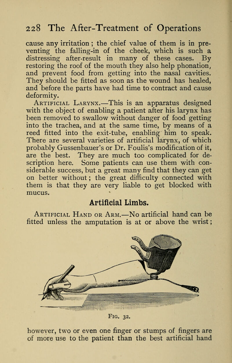 cause any irritation ; the chief value of them is in pre- venting the falling-in of the cheek, which is such a distressing after-result in many of these cases. By restoring the roof of the mouth they also help phonation, and prevent food from getting into the nasal cavities. They should be fitted as soon as the wound has healed, and before the parts have had time to contract and cause deformity. Artificial Larynx.—This is an apparatus designed with the object of enabling a patient after his larynx has been removed to swallow without danger of food getting into the trachea, and at the same time, by means of a reed fitted into the exit-tube, enabling him to speak. There are several varieties of artificial larynx, of which probably Gussenbauer's or Dr. Foulis's modification of it, are the best. They are much too complicated for de- scription here. Some patients can use them with con- siderable success, but a great many find that they can get on better without; the great difficulty connected with them is that they are very liable to get blocked with mucus. Artificial Limbs. Artificial Hand or Arm.—No artificial hand can be fitted unless the amputation is at or above the wrist; Fig. 32. however, two or even one finger or stumps of fingers are of more use to the patient than the best artificial hand