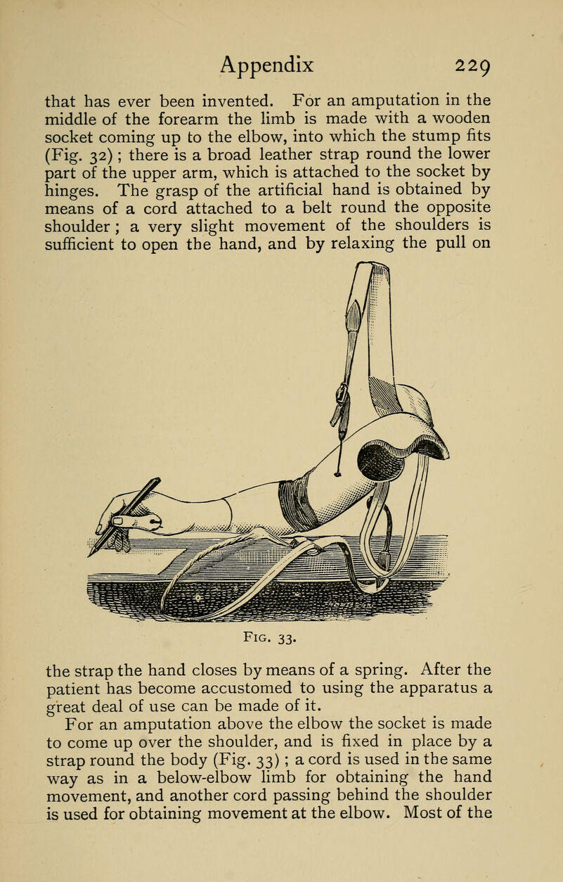 that has ever been invented. For an amputation in the middle of the forearm the limb is made with a wooden socket coming up to the elbow, into which the stump fits (Fig. 32); there is a broad leather strap round the lower part of the upper arm, which is attached to the socket by hinges. The grasp of the artificial hand is obtained by means of a cord attached to a belt round the opposite shoulder ; a very slight movement of the shoulders is sufficient to open the hand, and by relaxing the pull on Fig. 33. the strap the hand closes by means of a spring. After the patient has become accustomed to using the apparatus a great deal of use can be made of it. For an amputation above the elbow the socket is made to come up over the shoulder, and is fixed in place by a strap round the body (Fig. 33); a cord is used in the same way as in a below-elbow limb for obtaining the hand movement, and another cord passing behind the shoulder is used for obtaining movement at the elbow. Most of the