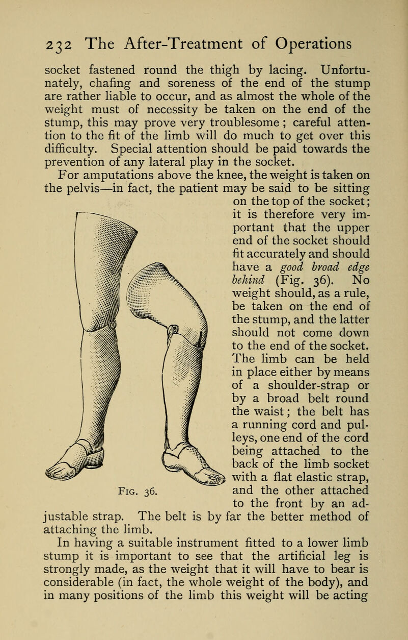 socket fastened round the thigh by lacing. Unfortu- nately, chafing and soreness of the end of the stump are rather liable to occur, and as almost the whole of the weight must of necessity be taken on the end of the stump, this may prove very troublesome ; careful atten- tion to the fit of the limb will do much to get over this difficulty. Special attention should be paid towards the prevention of any lateral play in the socket. For amputations above the knee, the weight is taken on the pelvis—in fact, the patient may be said to be sitting on the top of the socket; it is therefore very im- portant that the upper end of the socket should fit accurately and should have a good broad edge behind (Fig. 36). No weight should, as a rule, be taken on the end of the stump, and the latter should not come down to the end of the socket. The limb can be held in place either by means of a shoulder-strap or by a broad belt round the waist; the belt has a running cord and pul- leys, one end of the cord being attached to the back of the limb socket with a flat elastic strap, to the front by an ad- justable strap. The belt is by far the better method of attaching the limb. In having a suitable instrument fitted to a lower limb stump it is important to see that the artificial leg is strongly made, as the weight that it will have to bear is considerable (in fact, the whole weight of the body), and in many positions of the limb this weight will be acting