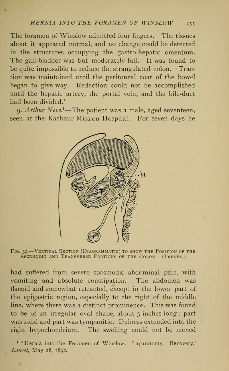 The foramen of Winslow admitted four fingers. The tissues about it appeared normal, and no change could be detected in the structures occupying the gastro-hepatic omentum. The gall-bladder was but moderately full. It was found to be quite impossible to reduce the strangulated colon. Trac- tion was maintained until the peritoneal coat of the bowel began to give way. Reduction could not be accomplished until the hepatic artery, the portal vein, and the bile-duct had been divided.' 9. Arthur Neve.1—The patient was a male, aged seventeen, seen at the Kashmir Mission Hospital. For seven days he Fig. 39.—Vertical Section (Diagrammatic) to show the Position of the Ascending and Transverse Portions of the Colon. (Treves.) had suffered from severe spasmodic abdominal pain, with vomiting and absolute constipation. The abdomen was flaccid and somewhat retracted, except in the lower part of the epigastric region, especially to the right of the middle line, where there was a distinct prominence. This was found to be of an irregular oval shape, about 5 inches long; part was solid and part was tympanitic. Dulness extended into the right hypochondrium. The swelling could not be moved 1 'Hernia into the Foramen of Winslow. Laparotomy. Recovery,' Lancet, May 28, 1892.