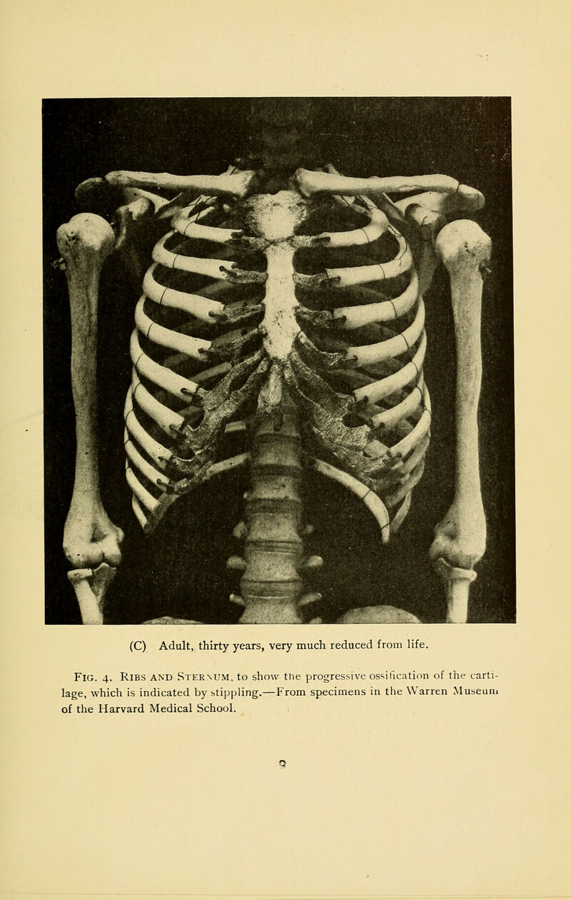 (C) Adult, thirty years, very much reduced from life. Fig. 4. Ribs and Sternum, to show the progressive ossification of the carti- lage, which is indicated by stippling.—From specimens in the Warren Museum of the Harvard Medical School.