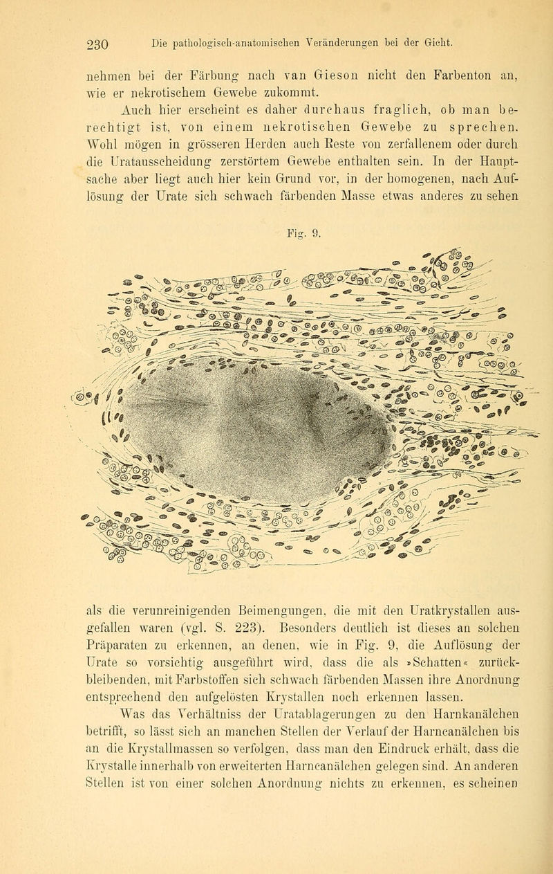 nehmen bei der Färbimg nach van Gieson nicht den Farbenton an, wie er nekrotischem Gewebe zukommt. Auch hier erscheint es daher durchaus fraglich, ob man be- rechtigt ist, von einem nekrotischen Gewebe zu sprechen. Wohl mögen in grösseren Herden auch Beste von zerfallenem oder durch die Uratausscheidung zerstörtem Gewebe enthalten sein. In der Haupt- sache aber liegt auch hier kein Grund vor, in der homogenen, nach Auf- lösung der Urate sich schwach färbenden Masse etwas anderes zu sehen Fig. 9. als die verunreinigenden Beimengungen, die mit den Uratkrystallen aus- gefallen waren (vgl. S. 223). Besonders deutlich ist dieses an solchen Präparaten zu erkennen, an denen, wie in Fig. 9, die Auflösung der Urate so vorsichtig ausgeführt wird, dass die als »Schatten« zurück- bleibenden, mit Farbstoffen sich schwach färbenden Massen ihre Anordnung entsprechend den aufgelösten Krystallen noch erkennen lassen. Was das Yerhältniss der Uratablagerungen zu den Harnkanälchen betrifft, so lässt sich an manchen Stellen der Verlauf der Harncanälchen bis an die Krystallmassen so verfolgen, dass man den Eindruck erhält, dass die Krystalle innerhalb von erweiterten Harncanälchen gelegen sind. An anderen Stellen ist von einer solchen Anorduune; nichts zu erkennen, es scheinen