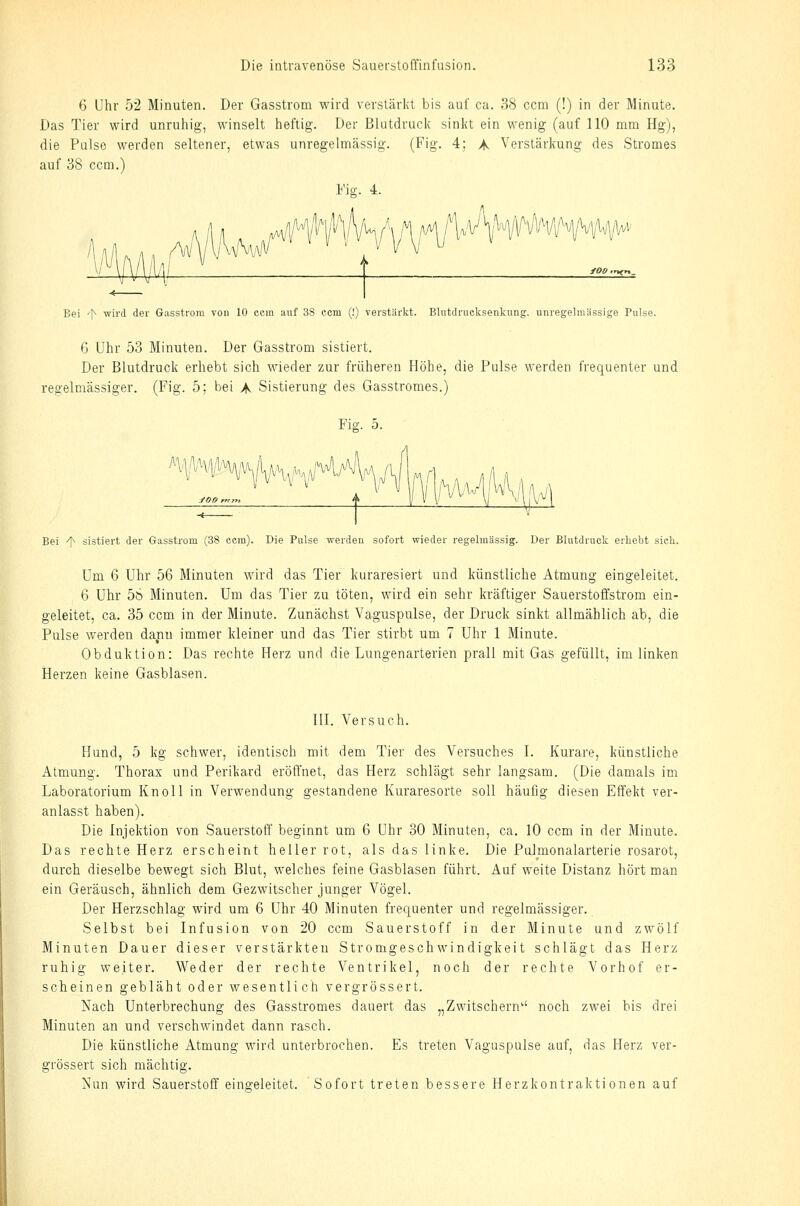 6 Uhr 52 Minuten. Der Gasstrom wird verstärkt bis auf ca. 38 ccm (!) in der Minute. Das Tier wird unruiiig, winselt heftig. Der Blutdruck sinkt ein wenig (auf 110 mm Hg), die Pulse werden seltener, etwas unregelmässig. (Fig. 4; A Verstärkung des Stromes auf 38 ccm.) Fis:. 4. 'm A ;u ^ wHn^i'l.Ä/yyYv'^^'*^^^^^^^^ 4i- Bei '^ wird der Gasstrom von 10 ccm auf 38 ccm (!) verstärkt. Bliitdrucksenknng. unregelmässige Pulse. 6 Uhr 53 Minuten. Der Gasstrom sistiert. Der Blutdruck erhebt sich wieder zur früheren Höhe, die Pulse werden frequenter und regelmässiger. (Fig. 5; bei A Sistierung des Gasstromes.) Fig. 5. Bei '^ sistiert der Gasstrom (38 ccm). Die Pulse werden sofort wieder regelmässig. Der Blutdruck erhebt sich. Um 6 Uhr 56 Minuten wird das Tier kuraresiert und künstliche Atmung eingeleitet. 6 Uhr 56 Minuten. Um das Tier zu töten, wird ein sehr kräftiger Sauerstoffstrom ein- geleitet, ca. 35 ccm in der Minute. Zunächst Vaguspulse, der Druck sinkt allmählich ab, die Pulse werden dann immer Meiner und das Tier stirbt um 7 Uhr 1 Minute. Obduktion: Das rechte Herz und die Lungenarterien prall mit Gas gefüllt, im linken Herzen keine Gasblasen. ni. Versuch. Hund, 5 leg schwer, identisch mit dem Tier des Versuches I. Kurare, künstliche Atmung. Thorax und Perikard eröffnet, das Herz schlägt sehr langsam. (Die damals im Laboratorium Knoll in Verwendung gestandene Kuraresorte soll häufig diesen Effekt ver- anlasst haben). Die Injektion von Sauerstoff beginnt um 6 Uhr 30 Minuten, ca. 10 ccm in der Minute. Das rechte Herz erscheint heller rot, als das linke. Die Pulmonalarterie rosarot, durch dieselbe bewegt sich Blut, welches feine Gasblasen führt. Auf weite Distanz hört man ein Geräusch, ähnlich dem Gezwitscher junger Vögel. Der Herzschlag wird um 6 Uhr 40 Minuten frequenter und regelmässiger. Selbst bei Infusion von 20 ccm Sauerstoff in der Minute und zwölf Minuten Dauer dieser verstärkten Stromgeschwindigkeit schlägt das Herz ruhig weiter. Weder der rechte Ventrikel, noch der rechte Vorhof er- scheinen gebläht oder wesentlich vergrössert. Nach Unterbrechung des Gasstromes dauert das „Zwitschern'' noch zwei bis drei Minuten an und verschwindet dann rasch. Die künstliche Atmung wird unterbrochen. Es treten Vaguspulse auf, das Herz ver- grössert sich mächtig. Nun wird Sauerstoff eingeleitet. Sofort treten bessere Herzkontraktionen auf