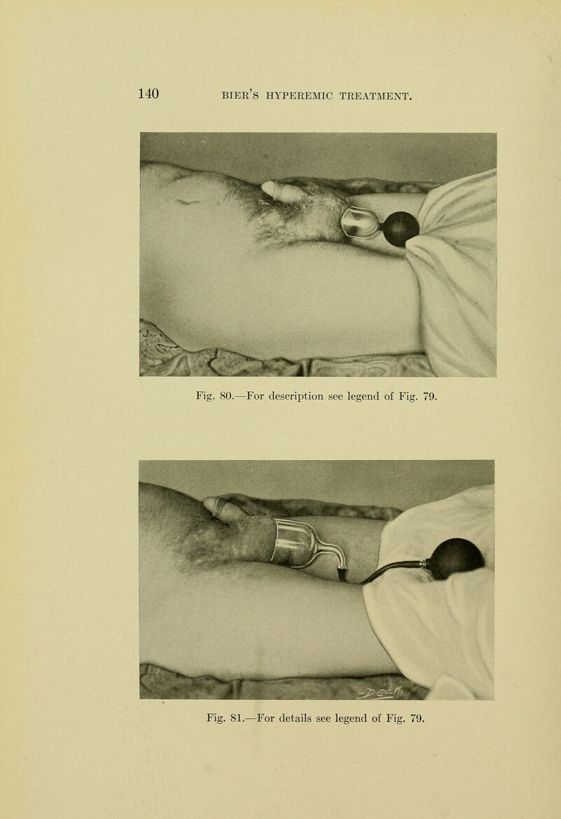 Fig. 80.—For description see legend of Fig. 79. Fig. 81.—For details see legend of Fig. 79.