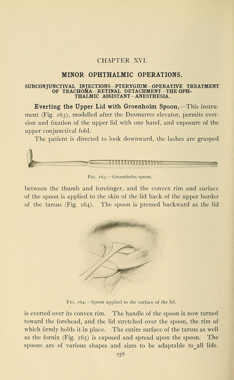 CHAPTER XVI. MINOR OPHTHALMIC OPERATIONS. SUBCONJUNCTIVAL INJECTIONS—PTERYGIUM—OPERATIVE TREATMENT OF TRACHOMA—RETINAL DETACHMENT—THE OPH- THALMIC ASSISTANT—ANESTHESIA. Everting the Upper Lid with Groenholm Spoon.—This Instru- ment (Fig. 163), modelled after the Desmarres elevator, permits ever- sion and fixation of the upper lid with one hand, and exposure of the upper conjunctival fold. The patient is directed to look downward, the lashes are grasped -*dZTTnTTTTTrmiTTTn Fig. 163.—Groenholm spoon. between the thumb and forefinger, and the convex rim and surface of the spoon is applied to the skin of the lid back of the upper border of the tarsus (Fig. 164). The spoon is pressed backward as the lid / Fig. 164.—Spoon applied to the surface of the lid. is everted over its convex rim. The handle of the spoon is now turned toward the forehead, and the lid stretched over the spoon, the rim of which firmly holds it in place. The entire surface of the tarsus as well as the fornix (Fig. 165) is exposed and spread upon the spoon. The spoons are of various shapes and sizes to be adaptable to_all lids.