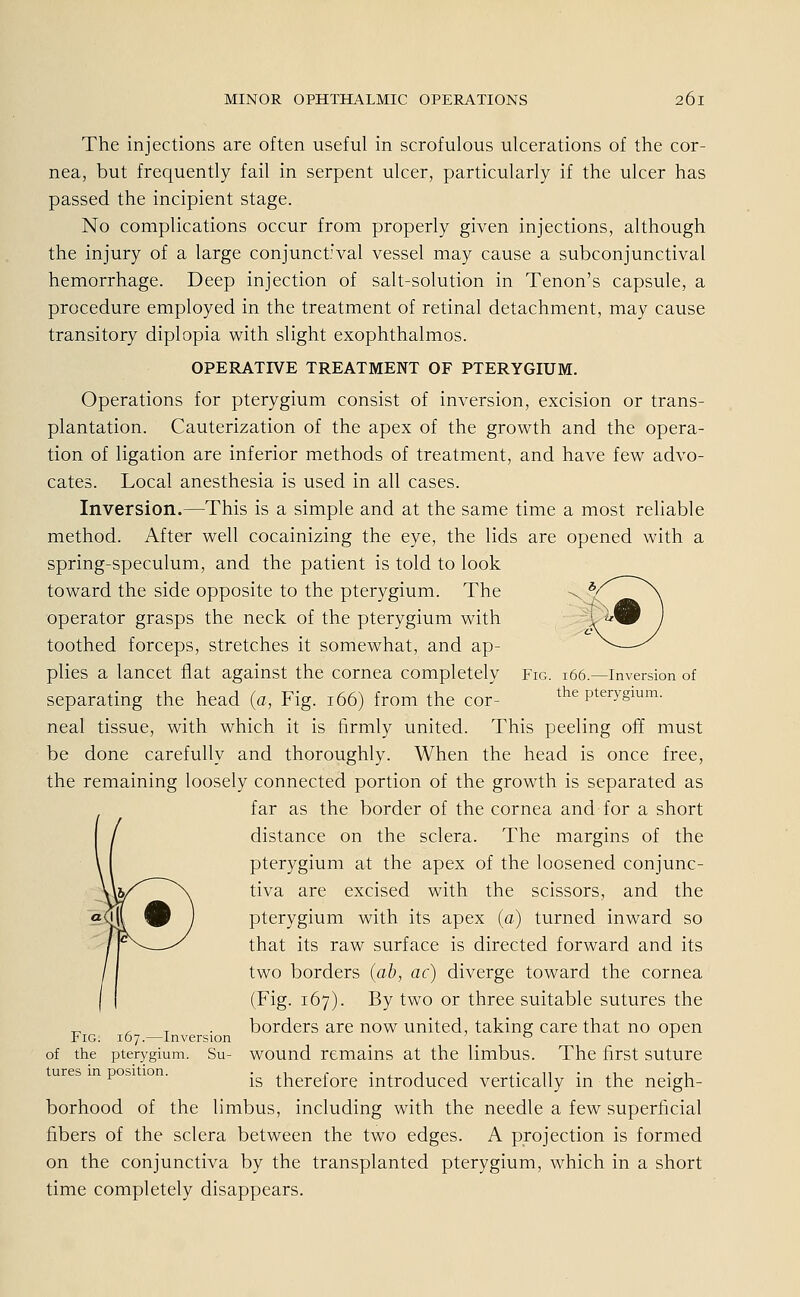 The injections are often useful in scrofulous ulcerations of the Cor- nea, but frequently fail in serpent ulcer, particularly if the ulcer has passed the incipient stage. No complications occur from properly given injections, although the injury of a large conjunct'val vessel may cause a subconjunctival hemorrhage. Deep injection of salt-solution in Tenon's capsule, a procedure employed in the treatment of retinal detachment, may cause transitory diplopia with slight exophthalmos. OPERATIVE TREATMENT OF PTERYGIUM. Operations for pterygium consist of inversion, excision or trans- plantation. Cauterization of the apex of the growth and the Opera- tion of ligation are inferior methods of treatment, and have few advo- cates. Local anesthesia is used in all cases. Inversion.—This is a simple and at the same time a most reliable method. After well cocainizing the eye, the lids are opened with a spring-speculum, and the patient is told to look toward the side opposite to the pterygium. The Operator grasps the neck of the pterygium with toothed forceps, Stretches it somewhat, and ap- plies a lancet flat against the Cornea completely separating the head (a, Fig. 166) from the cor- neal tissue, with which it is firmly united. This peeling off must be done carefully and thoroughly. When the head is once free, the remaining loosely connected portion of the growth is separated as far as the border of the Cornea and for a short distance on the sclera. The margins of the pterygium at the apex of the loosened conjunc- tiva are excised with the scissors, and the pterygium with its apex (a) turned inward so that its raw surface is directed forward and its two borders (ab, ac) diverge toward the Cornea (Fig. 167). By two or three suitable sutures the borders are now united, taking care that no open wound remains at the limbus. The first suture is therefore introduced vertically in the neigh- borhood of the limbus, including with the needle a few superficial fibers of the sclera between the two edges. A projection is formed on the conjunctiva by the transplanted pterygium, which in a short time completely disappears. Fig. 166.—Inversion of the pterygium. Fig. 167.—Inversion of the pterygium. Su- tures in position.