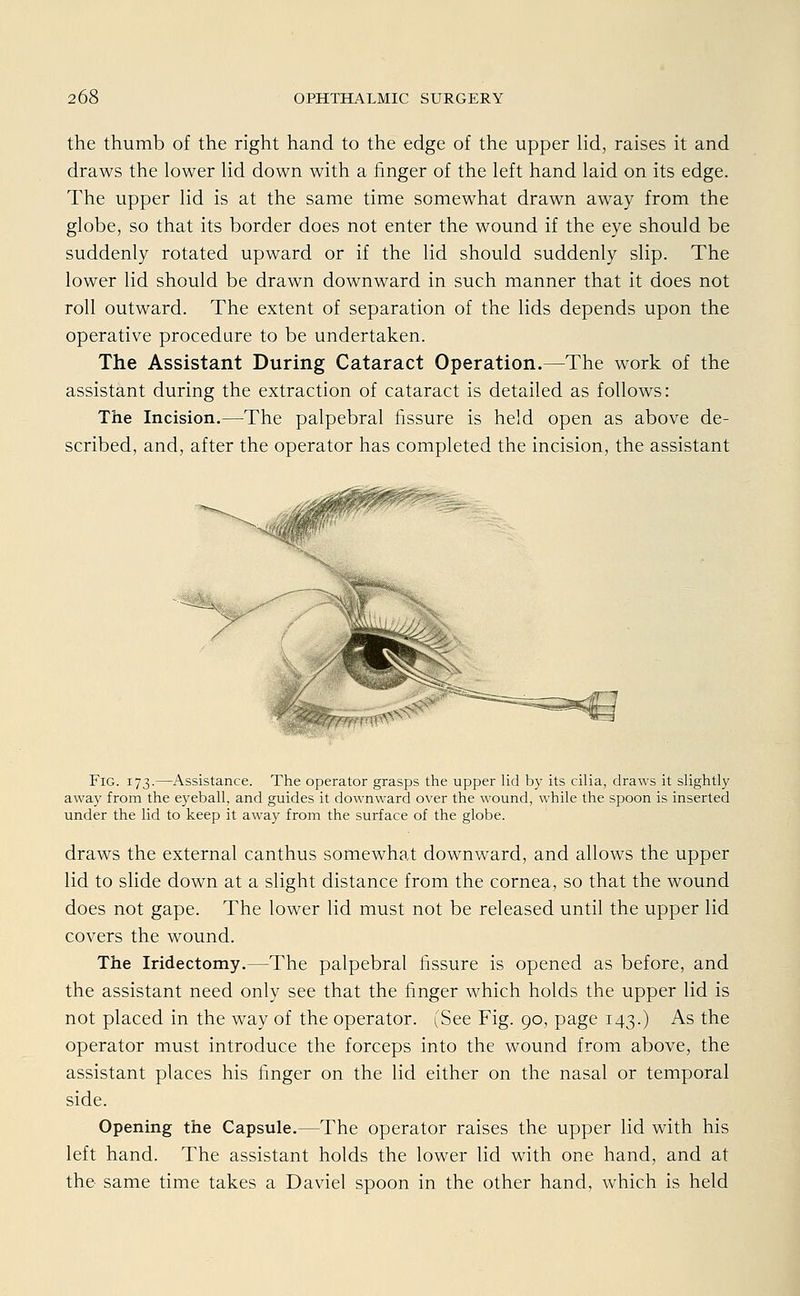 the thumb of the right hand to the edge of the upper lid, raises it and draws the lower lid down with a finger of the left hand laid on its edge. The upper lid is at the same time somewhat drawn away from the globe, so that its border does not enter the wound if the eye should be suddenly rotated upward or if the lid should suddenly slip. The lower lid should be drawn downward in such manner that it does not roll outward. The extent of Separation of the lids depends upon the operative procedure to be undertaken. The Assistant During Cataract Operation.—The work of the assistant during the extraction of cataract is detailed as follows: The Incision.—The palpebral fissure is held open as above de- scribed, and, after the Operator has completed the incision, the assistant Fig. 173.—Assistance. The Operator grasps the upper lid by its cilia, draws it slightly away from the eyeball. and guides it downward over the wound, while the spoon is inserted under the lid to keep it away from the surface of the globe. draws the external canthus somewhat downward, and allows the upper lid to slide down at a slight distance from the Cornea, so that the wound does not gape. The lower lid must not be released until the upper lid Covers the wound. The Iridectomy.—The palpebral fissure is opened as before, and the assistant need only see that the finger which holds the upper lid is not placed in the way of the Operator. (See Fig. 90, page 143.) As the Operator must introduce the forceps into the wound from above, the assistant places his finger on the lid either on the nasal or temporal side. Opening the Capsule.—The Operator raises the upper lid with his left hand. The assistant holds the lower lid with one hand, and at the same time takes a Daviel spoon in the other hand, which is held