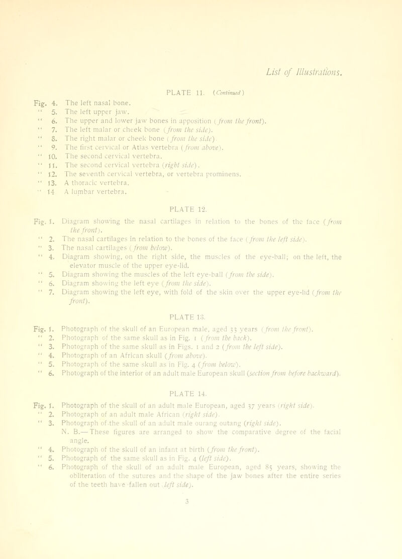 PLATE 11. {Co„tmu(d) Fig. 4. The left nasa! bone.  5. The left upper jaw.  6. The upper and lower jaw bones in apposition ( from the front).  7. The left malar or cheek bone (/row; t/ic side).  S. The right malar or cheek bone {from the side).  9. The first cervical or Atlas vertebra ( from above).  JO. The second cervical vertebra.  J I. The second cervical vertebra (nV/;/i/i/^') ■  12. The seventh cervical vertebra, or vertebra prominens.  J3. A thoracic vertebra. 14 A lumbar vertebra. PLATE 12. Fig-. J. Diagram showing the nasal cartilages in relation to the bones of the face (/mm the front).  2. The nasal cartilages in relation to the bones of the face ( from the left side).  3. The nasal cartilages ( from below).  4. Diagram showing, on the right side, the muscles of the eye-ball; on the left, the elevator muscle of the upper eye-lid.  5. Diagram showing the muscles of the left eye-ball (frohi tl.v side).  6. Diagram showing the left eye (from the side).  7. Diagram showing the left eye, with fold of the skin over the upper eye-lid (from the front). PLATE 13. Fig:. !• Photograph of the skull of an European male, aged 33 years (from i lie front). 2. Photograph of the same skull as in Fig. i ( from the back). 3. Photograph of the same skull as in Figs, i and 2 (from the left side). 4. Photograph of an African skull (from above). 5. Photograph of the same skull as in Fig. 4 (from beloiv). 6. Photograph of the interior of an adult male European skull (section from before baclsivard). PLATE 14. Fig. I. Photograph of the skull of an adult male European, aged 37 years {right side).  2. Photograph of an adult male African (right side).  3. Photograph of-the skull of an adult male ourang outang (right side). N. B.— These figures are arranged to show the comparative degree of the facial angle.  4. Photograph of the skull of an infant at birth (from the front).  5. Photograph of the same skull as in Fig. 4 (left side).  6. Photograph of the skull of an adult male European, aged 85 years, showing the obliteration of the sutures and the shape of the jaw bones after the entire series of the teeth have -fallen out ..left side).
