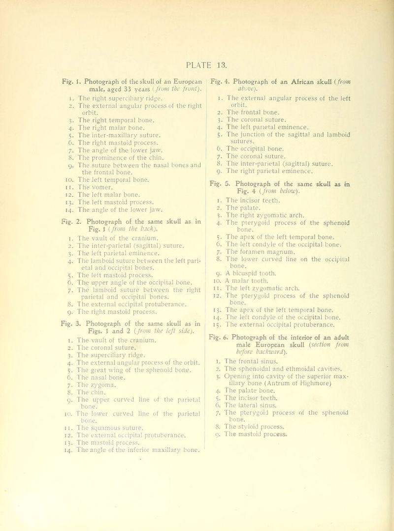 Fig. I. Photograph of the skull of an European male, aged 33 years {from the front). 1. The right superciliary ridge. 2. The external angular process of the right orbit. 3. The right temporal bone. 4. The right malar bone. 5. The inter-maxillary suture. 6. The right mastoid process. 7. The angle of the lower jaw. 8. The prominence of the chin. g. The suture between the nasal bones and the frontal bone. 10. The left temporal bone. 11. The vomer. 12. The left malar bone. 13. The left mastoid process. 14. The angle of the lower jaw. Fig. 2. Photograph of the same skull as in Fig. I {from the back). 1. The vault of the cranium. 2. The inter-parietal (sagittal) suture. 3. The left parietal eminence. 4. The lamboid suture between the left pari- etal and occipital bones. 5. The left mastoid process. 6. The upper angle of the occipital bone. 7. The lamboid suture between the right parietal and occipital bones. 8. The external occipital protuberance. 9. The right mastoid process. Fig. 3. Photograph of the same skull as in Figs. J and 2 {from the left side). 1. The vault of the cranium. 2. The coronal suture. 3. The superciliary ridge. 4. The external angular process of the orbit. 5. The great wing of the sphenoid bone. 6. The nasal bone. 7. The zj'goma. 8. The chin. Q. The upper curved line of the parietal bone. 10. The lower curved line of the parietal bone. 11. The squamous suture. 12. The external occipital protuberance. 13. The mastoid process. 14. The angle of the inferior maxillary bone. Fig. 4. Photograph of an African skull {from above). 1. The external angular process of the left orbit. 2. The frontal bone. 3. The coronal suture. 4. The left parietal eminence. 5. The junction of the sagittal and lamboid sutures. 6. The occipital bone. 7. The coronal suture. 8. The inter-parietal (sagittal) suture. The right parietal eminence. 9- Fig. I. 2. ^■ 4- 9- 10. II. 12. 13- 14. 15- Fig. 4- 5- 6. 7- 8. 9- 5. Photograph of the same skull as in Fig. 4 {from below). The incisor teeth. The palate. The right zygomatic arch. The pterygoid process of the sphenoid bone. The apex of the left temporal bone. The left condyle of the occipital bone. The foramen magnum. The lower curved line on the occipital bone. A bicuspid tooth. A malar tooth. The left zygomatic arch. The pterygoid process of the sphenoid bone. The apex of the left temporal bone. The left condyle of the occipital bone. The external occipital protuberance. 6. Photograph of the interior of an adult male European skull {section from before backward). The frontal sinus. The sphenoidal and ethmoidal cavities. Opening into cavity of the superior max- illary bone (Antrum of Highmore) The palate bone. The incisor teeth. The lateral sinus. The pterygoid process of the sphenoid bone. The styloid process. The mastoid process.