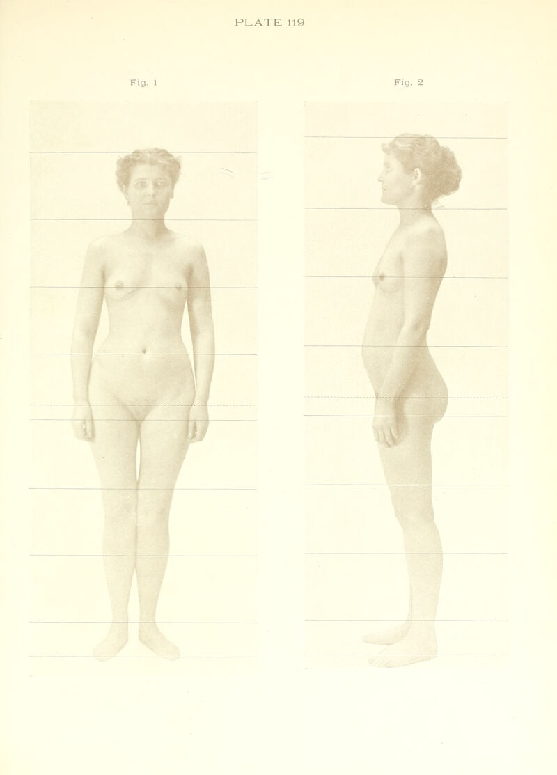 Fig. 1 Fig. 2 u / > w