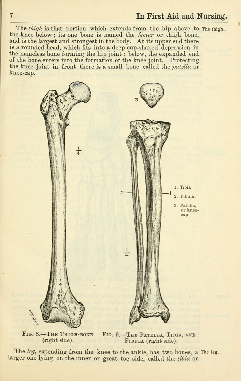 The thiqli is that portion which extends from the hip above to The thigh, the knee below; its one bone is named the femur or thigh bone, and is the largest and strongest in the body. At its upper end there is a rounded head, which fits into a deep cup-shaped depression in the nameless bone forming the hip joint; below, the expanded end of the bone enters into the formation of the knee joint. Protecting the knee joint in front there is a small bone called the patella or knee-cap. Fig. 8.—The Thigh-boxe (right side). Fig. 9.—The Patella, Tibia, and Fibula (right side). The leg^ extending from the knee to the ankle, has two bones, a The leg. larger one lying on the inner or great toe side, called the tibia or