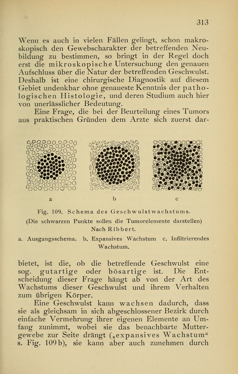 Wenn es auch in vielen Fällen gelingt, schon makro- skopisch den Gewebscharakter der betreffenden Neu- bildung zu bestimmen, so bringt in der Regel doch erst die mikroskopische Untersuchung den genauen Aufschluss über die Natur der betreffenden Geschwulst. Deshalb ist eine chirurgische Diagnostik auf diesem Gebiet undenkbar ohne genaueste Kenntnis der patho- logischen Histologie, und deren Studium auch hier von unerlässlicher Bedeutung. Eine Frage, die bei der Beurteilung eines Tumors aus praktischen Gründen dem Arzte sich zuerst dar- oooooo oooq Ooooo0 o Oon °o& °ooo°ocrocroo Fig. 109. Schema des Geschwulst Wachstums. (Die schwarzen Punkte sollen die Tumorelemente darstellen) Nach Ribbert. a. Ausgangsschema, b. Expansives Wachstum c. Infiltrierendes Wachstum. bietet, ist die, ob die betreffende Geschwulst eine sog. gutartige oder bösartige ist. Die Ent- scheidung dieser Frage hängt ab von der Art des Wachstums dieser Geschwulst und ihrem Verhalten zum übrigen Körper. Eine Geschwulst kann wachsen dadurch, dass sie als gleichsam in sich abgeschlossener Bezirk durch einfache Vermehrung ihrer eigenen Elemente an Um- fang zunimmt, wobei sie das benachbarte Mutter- gewebe zur Seite drängt („expansives Wachstum s. Fig. 109 b), sie kann aber auch zunehmen durch