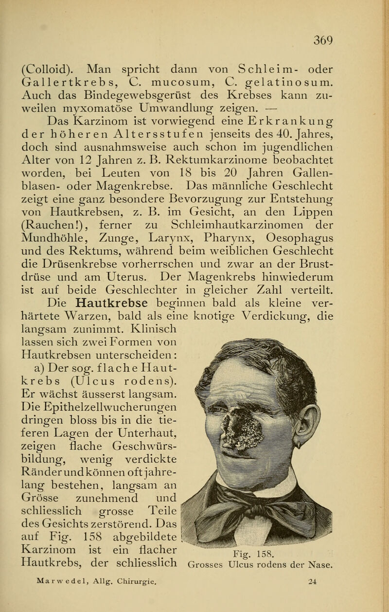 (Colloid). Man spricht dann von Schleim- oder Gallertkrebs, C. mucosum, C. gelatino sum. Auch das Bindegewebsgerüst des Krebses kann zu- weilen myxomatöse Umwandlung zeigen. — Das Karzinom ist vorwiegend eine Erkrankung der höheren Altersstufen jenseits des 40. Jahres, doch sind ausnahmsweise auch schon im jugendlichen Alter von 12 Jahren z. B. Rektumkarzinome beobachtet worden, bei Leuten von 18 bis 20 Jahren Gallen- blasen- oder Magenkrebse. Das männliche Geschlecht zeigt eine ganz besondere Bevorzugung zur Entstehung von Hautkrebsen, z. B. im Gesicht, an den Lippen (Rauchen!), ferner zu Schleimhautkarzinomen der Mundhöhle, Zunge, Larynx, Pharynx, Oesophagus und des Rektums, während beim weiblichen Geschlecht die Drüsenkrebse vorherrschen und zwar an der Brust- drüse und am Uterus. Der Magenkrebs hinwiederum ist auf beide Geschlechter in gleicher Zahl verteilt. Die Hautkrebse beginnen bald als kleine ver- härtete Warzen, bald als eine knotige Verdickung, die langsam zunimmt. Klinisch lassen sich zwei Formen von Hautkrebsen unterscheiden: a) Der sog. flache Haut- krebs (Ulcus rodens). Er wächst äusserst langsam. Die Epithelzellwucherungen dringen bloss bis in die tie- feren Lagen der Unterhaut, zeigen flache Geschwürs- bildung, wenig verdickte Ränder und können oft jahre- lang bestehen, langsam an Grösse zunehmend und schliesslich grosse Teile des Gesichts zerstörend. Das auf Fig. 158 abgebildete Karzinom ist ein flacher Hautkrebs, der schliesslich Grosses Fig. 158. Ulcus rodens der Nase. Mar w edel, Allg. Chirurgie. 24