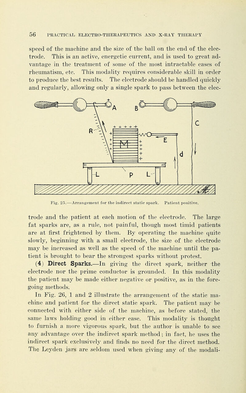 speed of the machine and the size of the ball on the end of the elec- trode. This is an active, energetic current, and is used to great ad- vantage in the treatment of some of the most intractable cases of rheumatism, etc. This modality requires considerable skill in order to produce the best results. The electrode should be handled quickly and regularly, allowing only a single spark to pass between the elec- Fig. 25.—Arrangement for the indirect static spark. Patient positive. trode and the patient at each motion of the electrode. The large fat sparks are, as a rule, not painful, though most timid patients are at first frightened by them. By operating the machine quite slowly, beginning with a small electrode, the size of the electrode may be increased as well as the speed of the machine until the pa- tient is brought to bear the strongest sparks without protest. (4) Direct Sparks.—In giving the direct spark, neither the electrode nor the prime conductor is grounded. In this modality the patient may be made either negative or positive, as in the fore- going methods. In Fig. 26, 1 and 2 illustrate the arrangement of the static ma- chine and patient for the direct static spark. The patient may be connected with either side of the machine, as before stated, the same laws holding good in either case. This modality is thought to furnish a more vigorous spark, but the author is unable to see any advantage over the indirect spark method; in fact, he uses the indirect spark exclusively and finds no need for the direct method. The Ley den jars are seldom used when giving any of the modali-