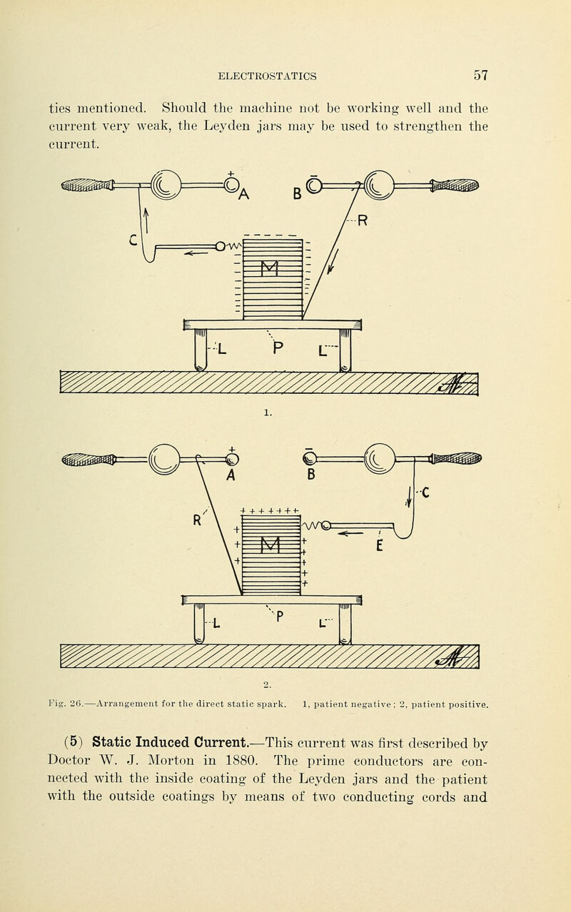 ties mentioned. Should the machine not be working well and the current very weak, the Ley den jars may be used to strengthen the current. Fig. 26.—Arrangement for the direct static spark. 1, patient negative ; 2, patient positive. (5) Static Induced Current.—This current was first described by Doctor W. J. Morton in 1880. The prime conductors are con- nected with the inside coating of the Leyden jars and the patient with the outside coatings by means of two conducting cords and