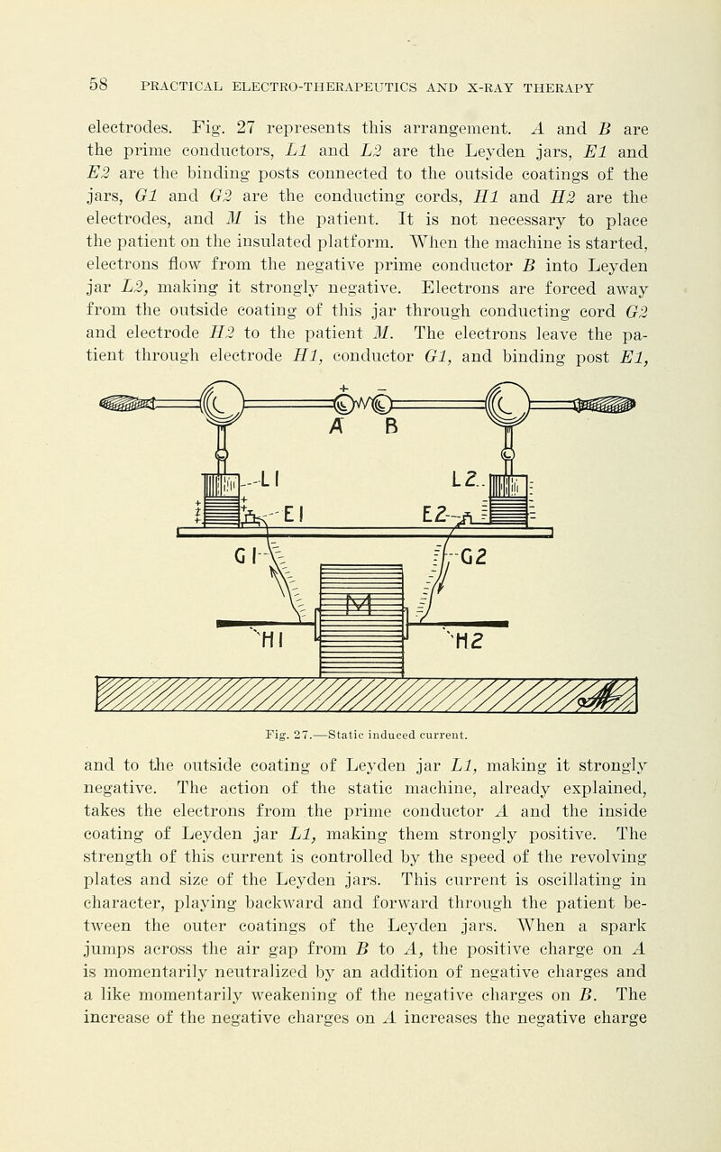 electrodes. Fig. 27 represents this arrangement. A and B are the prime conductors, Ll and L2 are the Leyden jars, El and E2 are the binding posts connected to the outside coatings of the jars, Gl and G2 are the conducting cords, HI and H2 are the electrodes, and M is the patient. It is not necessary to place the patient on the insulated platform. When the machine is started, electrons flow from the negative prime conductor B into Leyden jar L2, making it strongly negative. Electrons are forced away from the outside coating of this jar through conducting cord G2 and electrode H2 to the patient M. The electrons leave the pa- tient through electrode HI, conductor Gl, and binding post El, Fig. 27.—Static induced current. and to the outside coating of Leyden jar Ll, making it strongly negative. The action of the static machine, already explained, takes the electrons from the prime conductor A and the inside coating of Leyden jar Ll, making them strongly positive. The strength of this current is controlled by the speed of the revolving plates and size of the Leyden jars. This current is oscillating in character, playing backward and forward through the patient be- tween the outer coatings of the Leyden jars. When a spark jumps across the air gap from B to A, the positive charge on A is momentarily neutralized by an addition of negative charges and a like momentarily weakening of the negative charges on B. The increase of the negative charges on A increases the negative charge