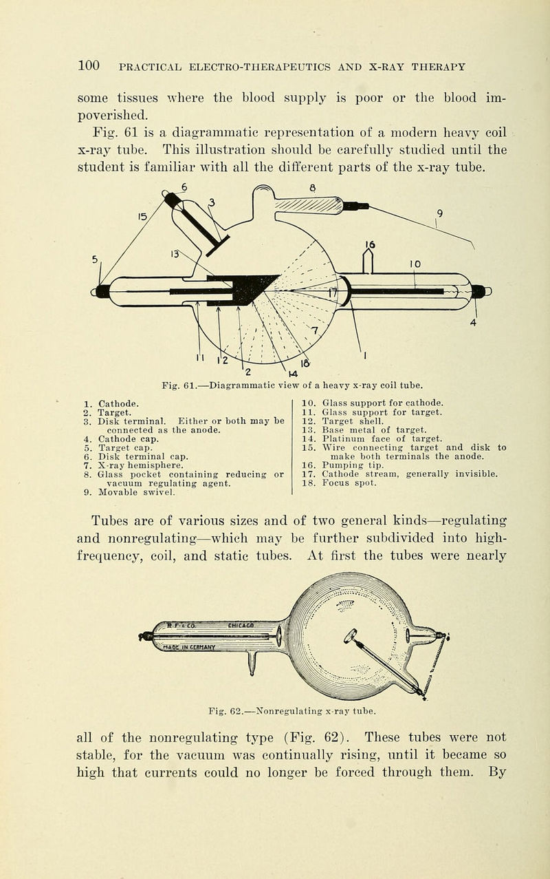 some tissues where the blood supply is poor or the blood im- poverished. Fig. 61 is a diagrammatic representation of a modern heavy coil x-ray tube. This illustration should be carefully studied until the student is familiar with all the different parts of the x-ray tube. 6 /^\ a n ,«2- '2 W Fig. 61.—Diagrammatic view of a heavy x-ray coil tube. 1. Cathode. 2. Target. 3. Disk terminal. Either or both may be connected as the anode. 4. Cathode cap. 5. Target cap. 6. Disk terminal cap. 7. X-ray hemisphere. 8. Glass pocket containing reducing or vacuum regulating agent. 9. Movable swivel. 10. Glass support for cathode. 11. Glass support for target. 12. Target shell. 13. Base metal of target. 14. Platinum face of target. 15. Wire connecting target and disk make both terminals the anode. 16. Pumping tip. 17. Cathode stream, generally invisible. 18. Focus spot. to Tubes are of various sizes and of two general kinds—regulating and nonregulating—which may be further subdivided into high- frequency, coil, and static tubes. At first the tubes were nearly Fig. 62.—Nonregulating x-ray tube. all of the nonregulating type (Fig. 62). These tubes were not stable, for the vacuum was continually rising, until it became so high that currents could no longer be forced through them. By
