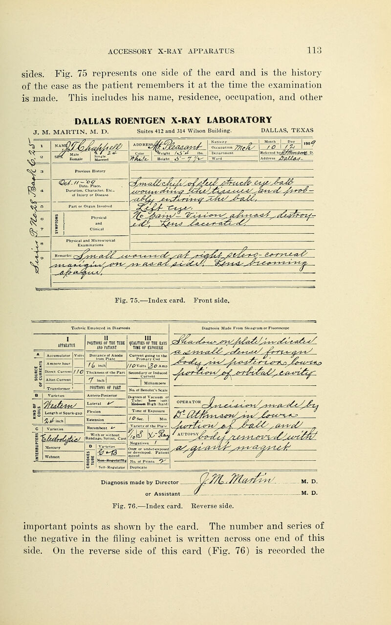 sides. Fig. 75 represents one side of the card and is the history of the case as the patient remembers it at the time the examination is made. This includes his name, residence, occupation, and other DALLAS ROENTGEN X-RAY LABORATORY J. M. MARTIN, M. D. Suites 412 and 314 Wilson Building. DALLAS, TEXAS ™°™SmJmUUU*™£ olT^on ?»,£; /O I / Zi I90f Referred hiflrf#yyi4*7>V P. Address &aZU4- s^t&i *)A^v4 ^a-e^^-a^L^tCS Remarks: r^^^Ug^ ^MH^^^ /-^^^^t^'- c^-T^^Z-^-^ j>sp-&j&Lt*Liz4- le^e^r Fig. 75.—Index card. Front side. Technic Employed ia Dia yf-JLA&tot/ Length ol Spark-£ */> It, mc| VgygtsLgg/ 7 lBdl| iwnws op part Lateral *^ Recumbent * Bandane, Splint. Ca -^■^3 III qCAMTIBS OF TUB RAVS TIMS OP ' Secondary or Indu No. o( Benolsi^S^al,. M Ifr-ff? • developed. Pati 'tzCfi-t-cs* ^-yi/sfadsa^^/z-Ts^ciZ^esaCi^i/ OPERATOR Diagnosis made by Director... or Assistant . Fig. 76.—Index card. Reverse side '■MJ&*t£ttL M. D. M. D. important points as shown by the card. The number and series of the negative in the filing cabinet is written across one end of this side. On the reverse side of this card (Fig. 76) is recorded the