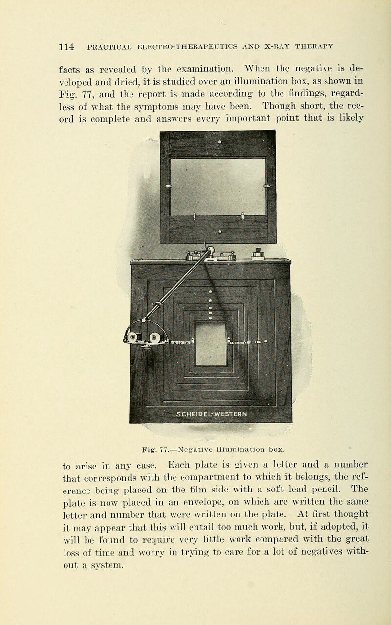facts as revealed by the examination. When the negative is de- veloped and dried, it is studied over an illumination box, as shown in Fig. 77, and the report is made according to the findings, regard- less of what the symptoms may have been. Though short, the rec- ord is complete and answers every important point that is likely Fig. 77.—Negative illumination box. to arise in any case. Each plate is given a letter and a number that corresponds with the compartment to which it belongs, the ref- erence being placed on the film side with a soft lead pencil. The plate is now placed in an envelope, on which are written the same letter and number that were written on the plate. At first thought it may appear that this will entail too much work, but, if adopted, it will be found to require very little work compared with the great loss of time and worry in trying to care for a lot of negatives with- out a system.
