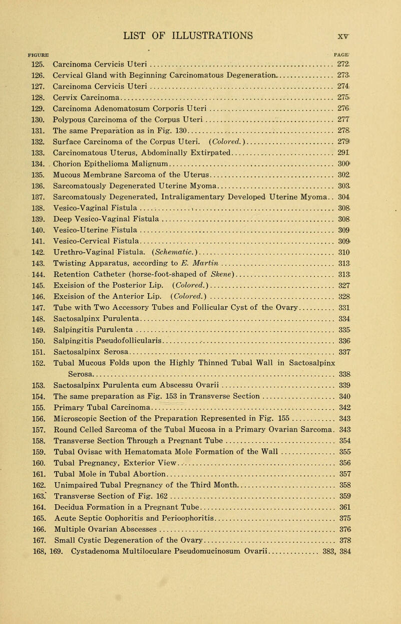 ?IGURE PAGE 125. Carcinoma Cervicis Uteri 272. 126. Cervical Gland with Beginning Carcinomatous Degeneration, 273. 127. Carcinoma Cervicis Uteri 274 128. Cervix Carcinoma — 275 129. Carcinoma Adenomatosum Corporis Uteri 276 130. Polypous Carcinoma of the Corpus Uteri 277 131. The same Preparation as in Fig. 130 :. 27& 132. Surface Carcinoma of the Corpus Uteri. (Colored.) 279> 133. Carcinomatous Uterus, Abdominally Extirpated 29L 134. . Chorion Epithelioma Malignum 300s 135. Mucous Membrane Sarcoma of the Uterus 302. 136. Sarcomatously Degenerated Uterine Myoma 303. 187. Sarcomatously Degenerated, Intraligamentary Developed Uterine Myoma.. 304 138. Vesico-Vaginal Fistula , 308. 139. Deep Vesico-Vaginal Fistula 308 140. Vesico-Uterine Fistula 309 141. Vesico-Cervical Fistula 309 142. Urethro-Vaginal Fistula. (Schematic.) 310 143. Twisting Apparatus, according to E. Martin 313 144. Retention Catheter (horse-foot-shaped of Skene) 313 145. Excision of the Posterior Lip. (Colored.) 327 146. Excision of the Anterior Lip. (Colored.) 328 147. Tube with Two Accessory Tubes and Follicular Cyst of the Ovary 331 148. Sactosalpinx Purulenta 334 149. Salpingitis Purulenta 335 150. Salpingitis Pseudofollicularis .• 336 151. Sactosalpinx Serosa 337 152. Tubal Mucous Folds upon the Highly Thinned Tubal Wall in Sactosalpinx Serosa 338 153. Sactosalpinx Purulenta cum Abscessu Ovarii 339 154. The same preparation as Fig. 153 in Transverse Section 340 155. Primary Tubal Carcinoma 342 156. Microscopic Section of the Preparation Represented in Fig. 155 343 157. Round Celled Sarcoma of the Tubal Mucosa in a Primary Ovarian Sarcoma. 343 158. Transverse Section Through a Pregnant Tube 354 159. Tubal Ovisac with Hematomata Mole Formation of the Wall 355 160. Tubal Pregnancy, Exterior View 356 161. Tubal Mole in Tubal Abortion 357 162. Unimpaired Tubal Pregnancy of the Third Month 358 163* Transverse Section of Fig. 162 359 164. Decidua Formation in a Pregnant Tube 361 165. Acute Septic Oophoritis and Perioophoritis 375 166. Multiple Ovarian Abscesses 376 167. Small Cystic Degeneration of the Ovary 378 168. 169. Cystadenoma Multiloculare Pseudomucinosum Ovarii 383, 384