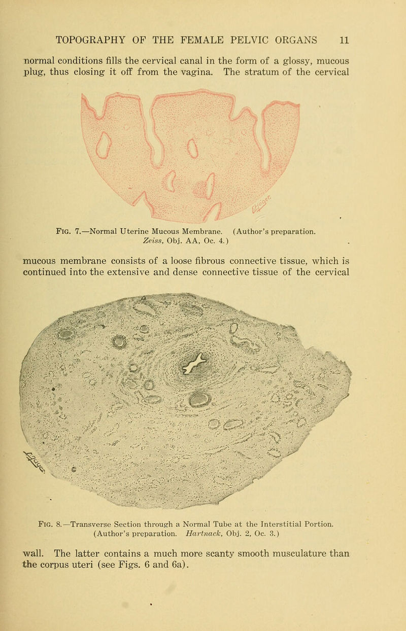 normal conditions fills the cervical canal in the form of a glossy, mucous plug, thus closing it off from the vagina. The stratum of the cervical Fig. 7.—Normal Uterine Mucous Membrane. (Author's preparation. Zeiss, Obj. AA, Oc. 4.) mucous membrane consists of a loose fibrous connective tissue, which is continued into the extensive and dense connective tissue of the cervical ***r7elm . ■*■&■ \ Fig. 8.—Transverse Section through a Normal Tube at the Interstitial Portion. (Author's preparation. Hartnack, Obj. 2, Oc. 3.) wall. The latter contains a much more scanty smooth musculature than the corpus uteri (see Figs. 6 and 6a).