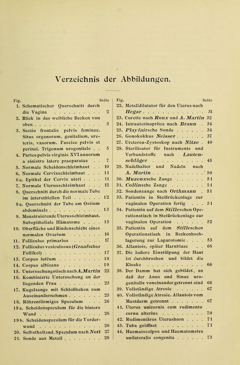 Verzeichnis der Abbildungen. Fig. Seite 1. Schematischer Querschnitt durch die Vagina 2 2. Blick in das weibliche Becken von oben 3 3. Sectio frontalis pelvis feminae. Situs organorum, genitalium, ure- teris, vasorum. Fasciae pelvis et perinei. Trigonum urogenitale . . 5 4. Partes pelvis virginis XVI annorum a sinistro latere praeparatae . . 7 5. Normale Scheidenschleimhaut . . 10 6. Normale Cervixschleimhaut ... 11 6 a. Epithel der Cervix uteri .... 11 7. Normale Uterusschleimhaut ... 12 8. Querschnitt durch die normale Tube im interstitiellen Teil 12 8 a. Querschnitt der Tube am Ostium abdominale 13 9. Menstruierende Uterusschleimhaut. Subepitheliale Hämatome .... 15 10. Oberfläche und Rindenschicht eines normalen Ovarium 16 11. Folliculus primarius 17 12. Folliculus vesiculosus (Graafscher Follikel) 17 13. Corpus luteum 18 14. Corpus albicans 19 15. Untersuchungstisch nachA.Martin 22 16. Kombinierte Untersuchung an der liegenden Frau 23 17. Kugelzange mit Schloßhaken zum Auseinandernehmen 25 18. Röhrenförmiges Speculum ... 26 19 a. Scheidenspeculum für die hintere Wand 26 19 b. Scheidenspeculum für die Vorder- wand 26 20. Selbsthaltend. Speculum nachNott 27 21. Sonde aus Metall 28 Fig. 22. 23. 24. 25. 26. 27. 28. 29. 30. 31. 32. 33. 34. 35. 36. 37. 38. 39. 40. 41. 42. 43. 44. Seite Metalldilatator für den Uterus nach Hegar 31 Curette nach Roux und A. Martin 32 Intrauterinspritze nach Braun . 34 Playfairsche Sonde 34 Gonokokkus Neisser 37 Ureteren-Zystoskop nach Nitze . 40 Sterilisator für Instrumente und Verbandstoffe nach Lauten- schläger 45 Nadelhalter und Nadeln nach A. Martin '50 Muzeuxscho Zange 51 Collinschs Zange 51 Sondenzange nach Orthmann . 51 Patientin in Steißrückenlage zur vaginalen Operation fertig ... 51 Patientin auf dem Stilleschen Ope- rationstisch in Steißrückenlage zur vaginalen Operation 52 Patientin auf dem Stilleschen Operationstisch in Beckenhoch- lagerung zur Laparotomie .... 53 Allantois, später Harnblase . . 66 Die äußere Einstülpung der Haut ist durchbrochen und bildet die Kloake . 66 Der Damm hat sich gebildet, so daß der Anus und Sinus uro- genitalis voneinander getrennt sind 66 Vollständige Atresie 67 Vollständige Atresie. Allantois vom Mastdarm getrennt 67 Uterus unicornis cum rudimento cornu alterius 70 Rudimentäres Uterushorn .... 71 Tuba geöffnet 71 Haematocolpos und Haematometra unilateralis congenita 73