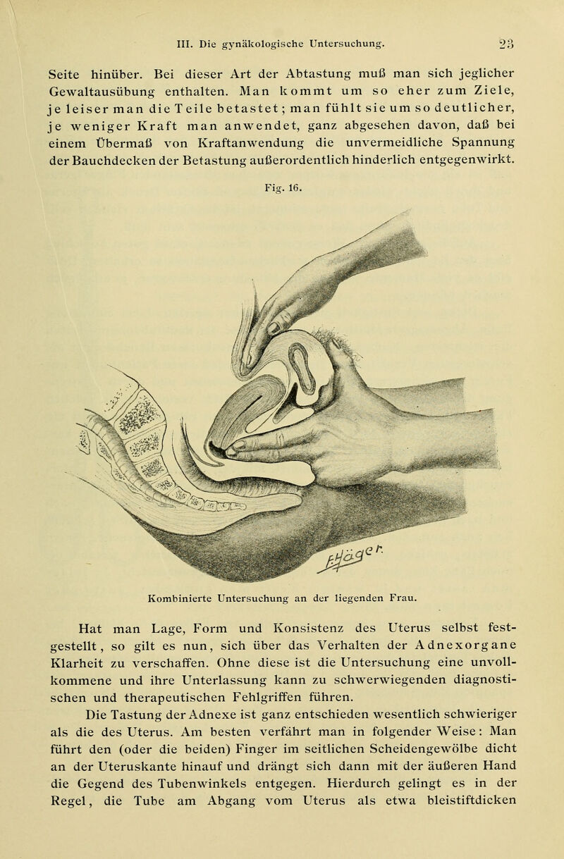 Seite hinüber. Bei dieser Art der Abtastung muß man sich jeglicher Gewaltausübung enthalten. Man kommt um so eher zum Ziele, je leiser man die Teile betastet; man fühlt sie um so deutlicher, je weniger Kraft man anwendet, ganz abgesehen davon, daß bei einem Übermaß von Kraftanwendung die unvermeidliche Spannung der Bauchdecken der Betastung außerordentlich hinderlich entgegenwirkt. Fig. 16. Kombinierte Untersuchung an der liegenden Frau. Hat man Lage, Form und Konsistenz des Uterus selbst fest- gestellt, so gilt es nun, sich über das Verhalten der Adnexorgane Klarheit zu verschaffen. Ohne diese ist die Untersuchung eine unvoll- kommene und ihre Unterlassung kann zu schwerwiegenden diagnosti- schen und therapeutischen Fehlgriffen führen. Die Tastung der Adnexe ist ganz entschieden wesentlich schwieriger als die des Uterus. Am besten verfährt man in folgender Weise: Man führt den (oder die beiden) Finger im seitlichen Scheidengewölbe dicht an der Uteruskante hinauf und drängt sich dann mit der äußeren Hand die Gegend des Tubenwinkels entgegen. Hierdurch gelingt es in der Regel, die Tube am Abgang vom Uterus als etwa bleistiftdicken
