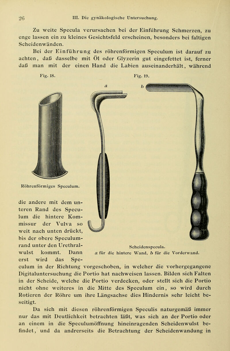 Zu weite Specula verursachen bei der Einführung Schmerzen, zu enge lassen ein zu kleines Gesichtsfeld erscheinen, besonders bei faltigen Scheidenwänden. Bei der Einführung des röhrenförmigen Speculum ist darauf zu achten, daß dasselbe mit Öl oder Glyzerin gut eingefettet ist, ferner daß man mit der einen Hand die Labien auseinanderhält, während Fi<?. 18. Fig. 19. Scheidenspecula. a für die hintere Wand, b für die Vorderwand. Röhrenförmiges Speculum. die andere mit dem un- teren Rand des Specu- lum die hintere Kom- missur der Vulva so weit nach unten drückt, bis der obere Speculum- rand unter den Urethral- wulst kommt. Dann erst wird das Spe- culum in der Richtung vorgeschoben, in welcher die vorhergegangene Digitaluntersuchung die Portio hat nachweisen lassen. Bilden sich Falten in der Scheide, welche die Portio verdecken, oder stellt sich die Portio nicht ohne weiteres in die Mitte des Speculum ein, so wird durch Rotieren der Röhre um ihre Längsachse dies Hindernis sehr leicht be- seitigt. Da sich mit diesen röhrenförmigen Speculis naturgemäß immer nur das mit Deutlichkeit betrachten läßt, was sich an der Portio oder an einem in die Speculumöffnung hineinragenden Scheidenwulst be- findet, und da andrerseits die Betrachtung der Scheidenwandung in