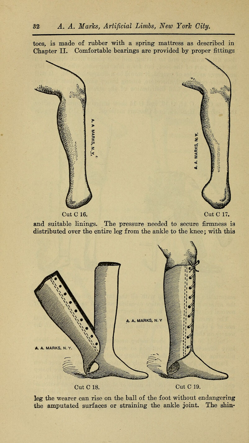 toes, is made of rubber witb a spring mattress as described in Chapter II. Comfortable bearings are provided by proper fittings Cut C 16. Cut C 17. and suitable linings. The pressure needed to secure firmness is distributed over the entire leg from the ankle to the knee; with this Cut C 18. Cut C 19. leg the wearer can rise on the ball of the foot without endangering the amputated surfaces or straining the ankle joint. The shin-