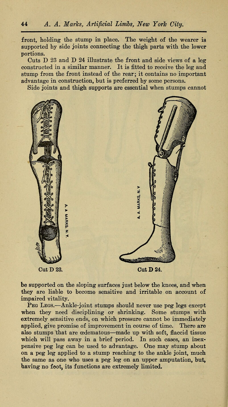 front, holding the stump in place. The weight of the wearer is supported by side joints connecting the thigh parts with the lower portions. Cuts D 23 and D 24 illustrate the front and side views of a leg constructed in a similar manner. It is fitted to receive the leg and stump from the front instead of the rear; it contains no important advantage in construction, but is preferred by some persons. Side joints and thigh supports are essential when stumps cannot ^ Cut D 23. Cut D 24. be supported on the sloping surfaces just below the knees, and when they are liable to become sensitive and irritable on account of impaired vitality. Peg Legs.—Ankle-joint stumps should never use peg legs except when they need disciplining or shrinking. Some stumps with extremely sensitive ends, on which pressure cannot be immediately applied, give promise of improvement in course of time. There are also stumps that are oedematous—made up with soft, flaccid tissue which will pass away in a brief period. In such cases, an inex- pensive peg leg can be used to advantage. One may stump about on a peg leg applied to a stump reaching to the ankle joint, much the same as one who uses a peg leg on an upper amputation, but, having no foot, its functions are extremely limited.