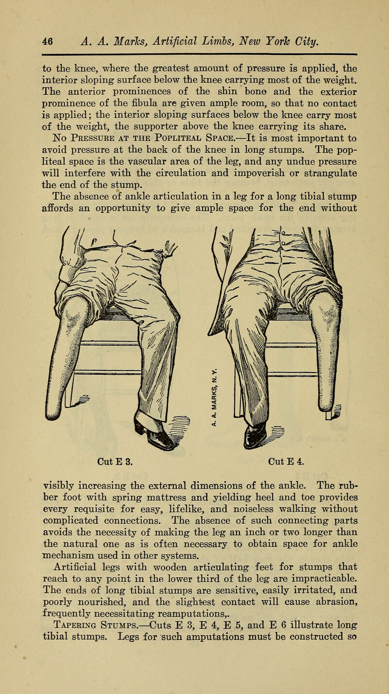 to the knee, where the greatest amount of pressure is applied, the interior sloping surface below the knee carrying most of the weight. The anterior prominences of the shin bone and the exterior prominence of the fibula are given ample room, so that no contact is applied; the interior sloping surfaces below the knee carry most of the weight, the supporter above the knee carrying its share. No Pressure at the Popliteal Space.—It is most important to avoid pressure at the back of the knee in long stumps. The pop- liteal space is the vascular area of the leg, and any undue pressure will interfere with the circulation and impoverish or strangulate the end of the stump. The absence of ankle articulation in a leg for a long tibial stump affords an opportunity to give ample space for the end without Cut E 3. Cut E 4. visibly increasing the external dimensions of the ankle. The rub- ber foot with spring mattress and yielding heel and toe provides every requisite for easy, lifelike, and noiseless walking without complicated connections. The absence of such connecting parts avoids the necessity of making the leg an inch or two longer than the natural one as is often necessary to obtain space for ankle mechanism used in other systems. Artificial legs with wooden articulating feet for stumps that reach to any point in the lower third of the leg are impracticable. The ends of long tibial stumps are sensitive, easily irritated, and poorly nourished, and the slightest contact will cause abrasion, frequently necessitating reamputations,. Tapering Stumps.—Outs E 3, E 4, E 5, and E 6 illustrate long tibial stumps. Legs for such amputations must be constructed so