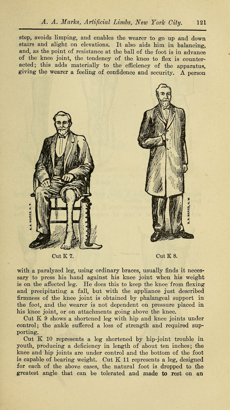 step, avoids limping, and enables the wearer to go up and down stairs and alight on elevations. It also aids him in balancing, and, as the point of resistance at the ball of the foot is in advance of the knee joint, the tendency of the knee to flex is counter- acted; this adds materially to the efficiency of the apparatus, giving the wearer a feeling of confidence and security. A person Cut K 7. Cut K 8. with a paralyzed leg, using ordinary braces, usually finds it neces- sary to press his hand against his knee joint when his weight is on the affected leg. He does this to keep the knee from flexing and precipitating a fall, but with the appliance just described firmness of the knee joint is obtained by phalangeal support in the foot, and the wearer is not dependent on pressure placed in his knee joint, or on attachments going above the knee. Cut K 9 shows a shortened leg with hip and knee joints under control; the ankle suffered a loss of strength and required sup- porting. Cut K 10 represents a leg shortened by hip-joint trouble in youth, producing a deficiency in length of about ten inches; the knee and hip joints are under control and the bottom of the foot is capable of bearing weight. Cut K 11 represents a leg, designed for each of the above cases, the natural foot is dropped to the greatest angle that can be tolerated and made to rest on an