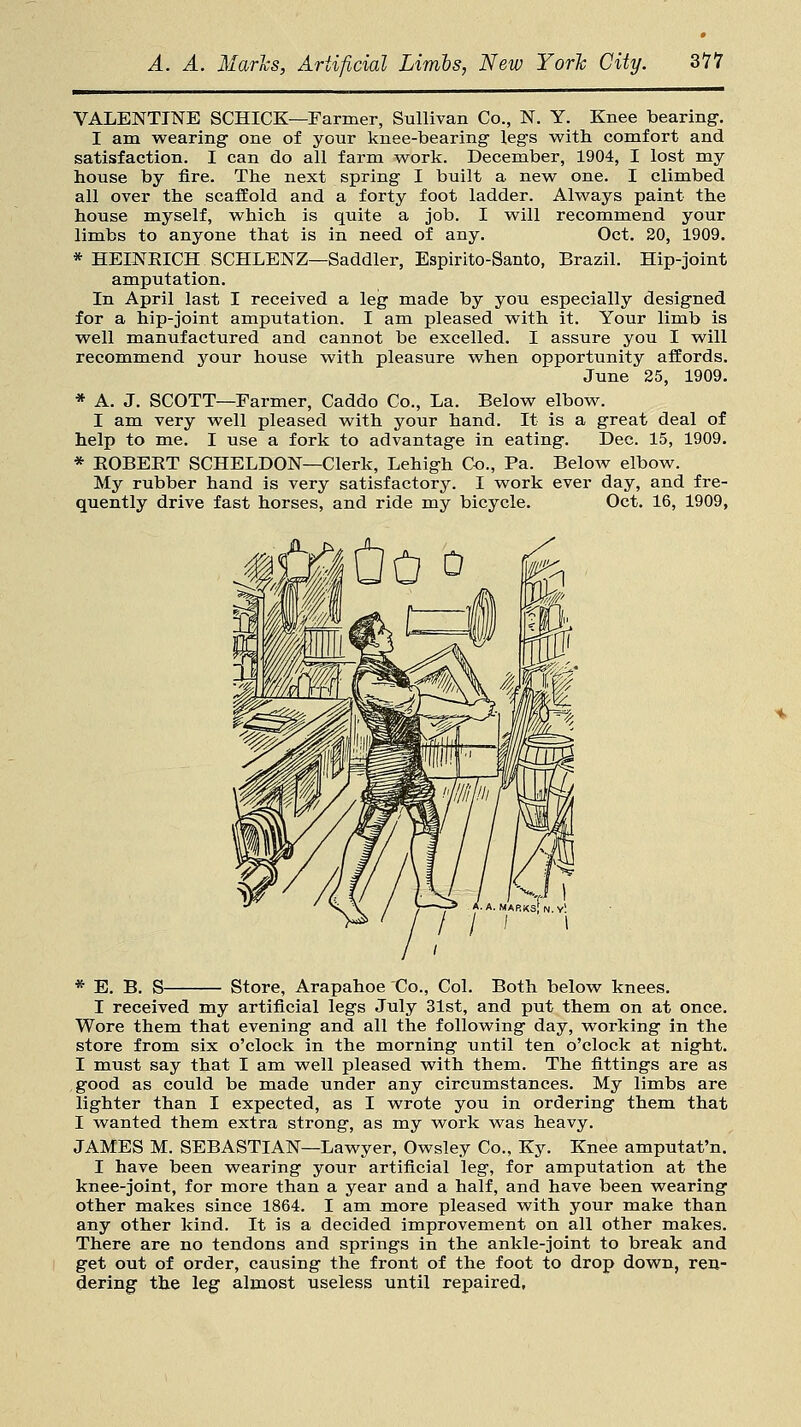 VALENTINE SCHICK—Farmer, Sullivan Co., N. Y. Knee bearing. I am wearing one of your knee-bearing legs with comfort and satisfaction. I can do all farm work. December, 1904, I lost my house by fire. The next spring I built a new one. I climbed all over the scaffold and a forty foot ladder. Always paint the house myself, which is quite a job. I will recommend your limbs to anyone that is in need of any. Oct. 20, 1909. * HEINRICH SCHLENZ—Saddler, Espirito-Santo, Brazil. Hip-joint amputation. In April last I received a leg made by you especially designed for a hip-joint amputation. I am pleased with it. Your limb is well manufactured and cannot be excelled. I assure you I will recommend your house with pleasure when opportunity affords. June 25, 1909. * A. J. SCOTT—Farmer, Caddo Co., La. Below elbow. I am very well pleased with your hand. It is a great deal of help to me. I use a fork to advantage in eating. Dec. 15, 1909. * ROBERT SCHELDON—Clerk, Lehigh Co., Pa. Below elbow. My rubber hand is very satisfactory. I work ever day, and fre- quently drive fast horses, and ride my bicycle. Oct. 16, 1909, * E. B. S Store, Arapahoe Co., Col. Both below knees. I received my artificial legs July 31st, and put them on at once. Wore them that evening and all the following day, working in the store from six o'clock in the morning until ten o'clock at night. I must say that I am well pleased with them. The fittings are as good as could be made under any circumstances. My limbs are lighter than I expected, as I wrote you in ordering them that I wanted them extra strong, as my work was heavy. JAMES M. SEBASTIAN—Lawyer, Owsley Co., Ky. Knee amputat'n. I have been wearing your artificial leg, for amputation at the knee-joint, for more than a year and a half, and have been wearing other makes since 1864. I am more pleased with your make than any other kind. It is a decided improvement on all other makes. There are no tendons and springs in the ankle-joint to break and get out of order, causing the front of the foot to drop down, ren- dering the leg almost useless until repaired,