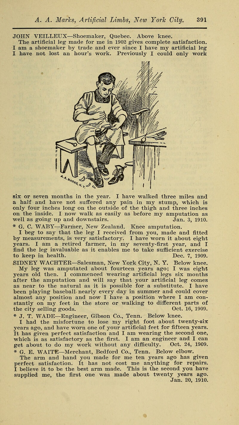 JOHN VEILLEUX—Shoemaker, Quebec. Above knee. The artificial leg made for me in 1902 gives complete satisfaction. I am a shoemaker by trade and ever since I have my artificial leg I have not lost an hour's work. Previously I could only work six or seven months in the year. I have walked three miles and a half and have not suffered any pain in my stump, which is only four inches long on the outside of the thigh and three inches on the inside. I now walk as easily as before my amputation as well as going up and downstairs. Jan. 3, 1910. * G. C. WABY—Farmer, New Zealand. Knee amputation. I beg to say that the leg I received from you, made and fitted by measurements, is very satisfactory. I have worn it about eight years. I am a retired farmer, in my seventy-first year, and I find the leg invaluable as it enables me to take sufficient exercise to keep in health. Dec. 7, 1909. SIDNEY WACHTEE—Salesman, New York City, N. Y. Below knee. My leg was amputated about fourteen years ago; I was eight years old then. I commenced wearing artificial legs six months after the amputation and will say that your artificial leg comes as near to the natural as it is possible for a substitute. I have been playing baseball nearly every day in summer and could cover almost any position and now I have a position where I am con- stantly on my feet in the store or walking to different parts of the city selling goods. Oct. 16, 1909. * J. T. WADE—Engineer, Gibson Co., Tenn. Below knee. I had the misfortune to lose my right foot about twenty-six years ago, and have worn one of your artificial feet for fifteen years. It has given perfect satisfaction and I am wearing the second one, which is as satisfactory as the first. I am an engineer and I can get about to do my work without any difficulty. Oct. 24, 1909. * G. E. WAITE—Merchant, Bedford Co., Tenn. Below elbow. The arm and hand you made for me ten years ago has given perfect satisfaction. It has not cost me anything for repairs. I believe it to be the best arm made. This is the second you have supplied me, the first one was made about twenty years ago. Jan. 20, 1910.