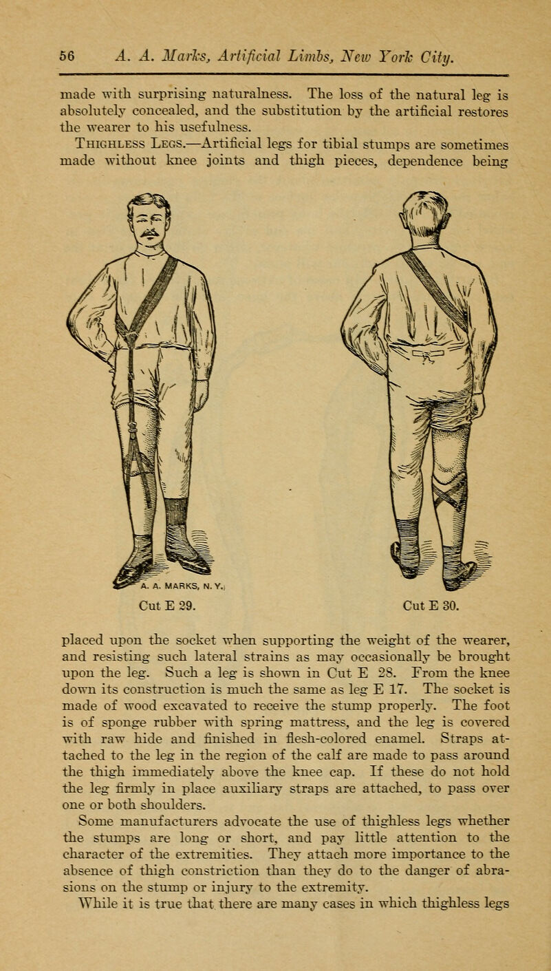 made with surprising naturalness. The loss of the natural leg is absolutely concealed, and the substitution by the artificial restores the wearer to his usefulness. Thighless Legs.—Artificial legs for tibial stumps are sometimes made without knee joints and thigh pieces, dependence being , A. MARKS, N. Y.) Cut E 29. Cut E 30. placed upon the socket when supporting the weight of the wearer, and resisting such lateral strains as may occasionally be brought upon the leg. Such a leg is shown in Cut E 2S. From the knee down its construction is much the same as leg E IT. The socket is made of wood excavated to receive the stump properly. The foot is of sponge rubber with spring mattress, and the leg is covered with raw hide and finished in flesh-colored enamel. Straps at- tached to the leg in the region of the calf are made to pass around the thigh immediat-ely above the knee cap. If these do not hold the leg firmly in place auxiliary straps are attached, to pass over one or both shoulders. Some manufacturers advocate the use of thighless legs whether the stumps are long or short, and pay little attention to the character of the extremities. They attach more importance to the absence of thigh constriction than they do to the danger of abra- sions on the stump or injury to the extremity. While it is true that, there are many cases in which thighless legs