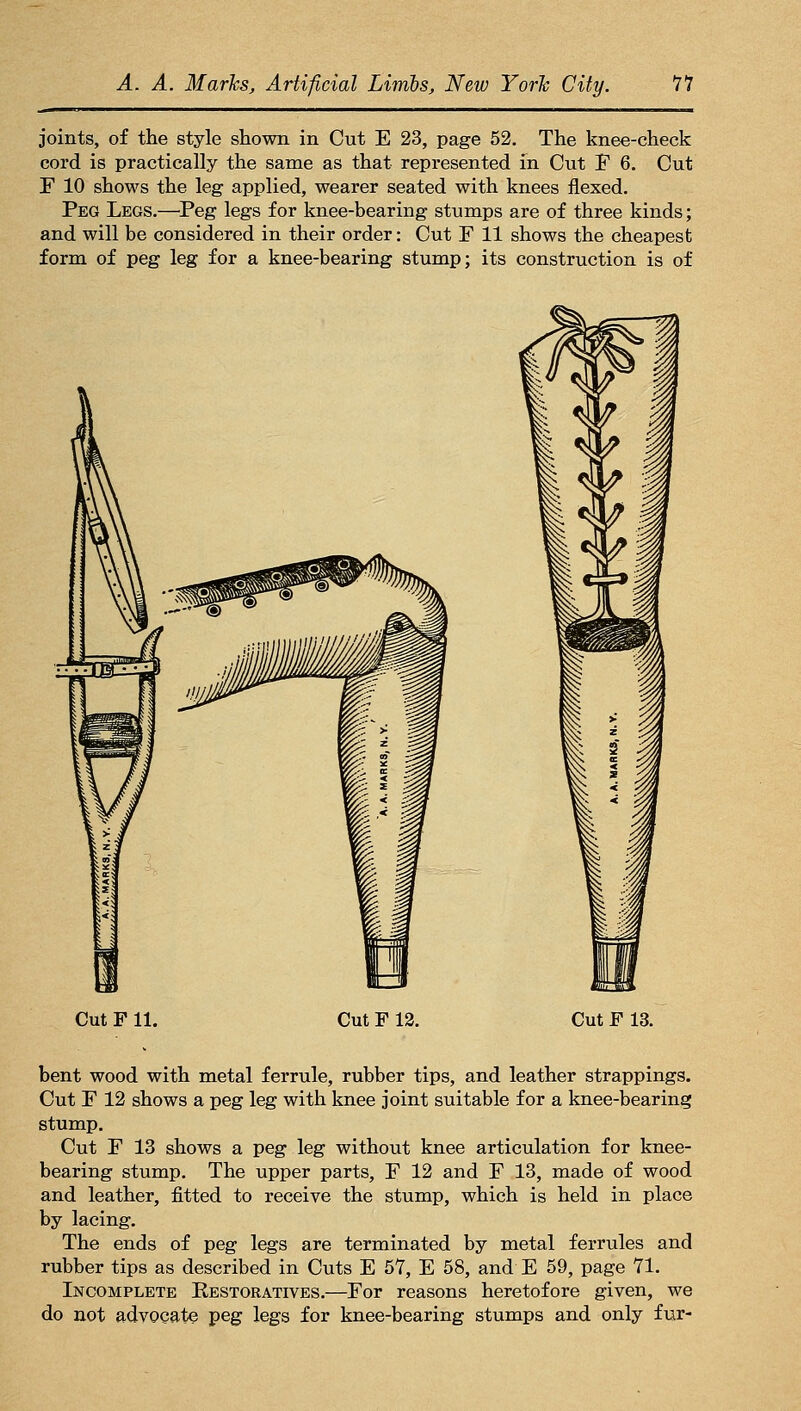 joints, of the style shown in Cut E 23, page 52. The knee-check cord is practically the same as that represented in Cut F 6. Cut F 10 shows the leg applied, wearer seated with knees flexed. Peg Legs.—^Peg legs for knee-bearing stumps are of three kinds; and will be considered in their order: Cut F 11 shows the cheapest form of peg leg for a knee-bearing stump; its construction is of Cut F 11. Cut F 12. Cut F 13. bent wood with metal ferrule, rubber tips, and leather strappings. Cut F 12 shows a peg leg with knee joint suitable for a knee-bearing stump. Cut F 13 shows a peg leg without knee articulation for knee- bearing stump. The upper parts, F 12 and F 13, made of wood and leather, fitted to receive the stump, which is held in place by lacing. The ends of peg legs are terminated by metal ferrules and rubber tips as described in Cuts E 57, E 58, and E 59, page 71. Incomplete Eestoratives.—For reasons heretofore given, we do not advocate peg legs for knee-bearing stumps and only fur-