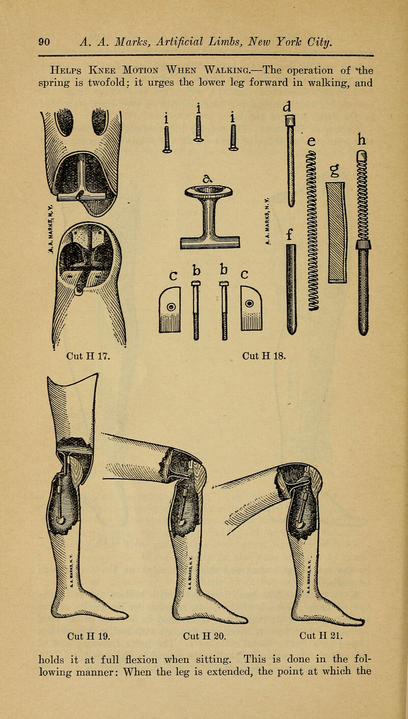 Helps Knee Motion When Walking.—The operation of *the spring is twofold: it urges the lower leg forward in walking, and Cut H 19. Cut H 20. Cut H 21. holds it at full flexion when sitting. This is done in the fol- lowing manner: When the leg is extended, the point at which the