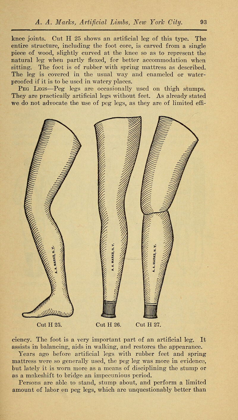 knee joints. Cut H 25 shows an artificial leg of this type. The entire structure, including the foot core, is carved from a single piece of wood, slightly curved at the knee so as to represent the natural leg when partly flexed, for better accommodation when sitting. The foot is of rubber with spring mattress as described. The leg is covered in the usual way and enameled or water- proofed if it is to be used in watery places. Peg Legs—Peg legs are occasionally used on thigh stumps. They are practically artificial legs without feet. As already stated we do not advocate the use of peg legs, as they are of limited effi- Cut H 25. Cut H 36. Cut H 27. eiency. The foot is a very important part of an artificial leg. It assists in balancing, aids in walking, and restores the appearance. Years ago before artificial legs with rubber feet and spring mattress were so generally used, the peg leg was more in evidence, but lately it is worn more as a means of disciplining the stump or as a makeshift to bridge an impecunious period. Persons are able to stand, stump about, and perform a limited amount of labor on peg legs, which are unquestionably better than