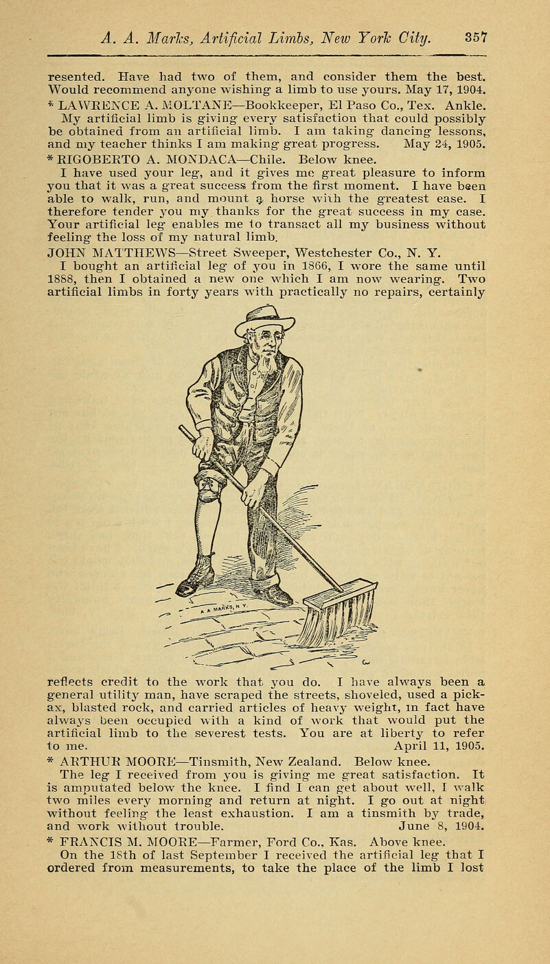 resented. Have had two of them, and consider them the best. Would recommend anyone wishing- a limb to use yours. May 17, 1904. * LAWEENCE A. MOLTANE—Bookkeeper, El Paso Co., Tex. Ankle. My artificial limb is giving every satisfaction that could possibly be obtained from an artificial limb. I am taking dancing lessons, and my teacher thinks I am making- great progress. May 24, 1905. *EIGOBEETO A. MONDACA—Chile. Below knee. I have used your leg, and it gives me great pleasure to inform you that it was a great success frora the first moment. I have bsen able to walk, run, and mount ^ horse with the greatest ease. I therefore tender you my thanks for the great success in my case. Your artificial leg- enables me to transact all my business without feeling the loss of my natural limb. JOHN MATTHEWS—Street Sweeper, Westchester Co., N. Y. I bought an artificial leg' of you in 1866, I wore the same until 1888, then I obtained a new one which I am now wearing. Two artificial limbs in forty years with practically no repairs, certainly reflects credit to the work that you do. I have always been a general utility man, have scraped the streets, shoveled, used a pick- ax, blasted rock, and carried articles of heavy weight, m fact have always been occupied with a kind of work that would put the artificial limb to the severest tests. You are at liberty to refer to me. April 11, 1905. * AETHUE MOOEE—Tinsmith, Ts^ew Zealand. Below knee. The leg I received from you is giving me great satisfaction. It is amputated below the knee. I find I can get about well, I walk two miles every morning and return at night. I go out at night without feeling the least exhaustion. I am a tinsmith by trade, and work without trouble. June 8, 1904. * FEANCIS M. MOOEE—Farmer, Ford Co., Kas. Above knee. On the ISth of last September I received the artificial leg that I ordered from measurements, to take the place of the limb I lost