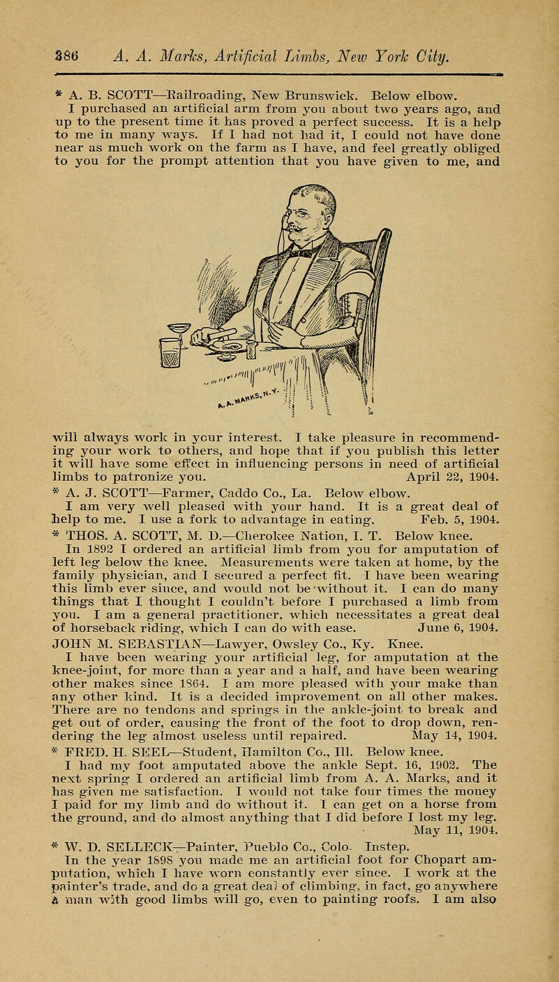 * A. B. SCOTT—Eailroading-, New Brunswick. Below elbow. I purchased an artificial arm from you about two years ago, and up to the present time it has proved a perfect success. It is a help to me in many ways. If I had not had it, I could not have done near as much work on the farm as I have, and feel greatly obliged to you for the prompt attention that you have given to me, and will always work in your interest. I take pleasure in recommend- ing your work to others, and hope that if you publish this letter it will have some effect in influencing persons in need of artificial limbs to patronize you. April 22, 1904. * A. J. SCOTT—Farmer, Caddo Co., La. Below elbow. I am very well pleased with your hand. It is a great deal of help to me. I use a fork to advantage in eating. Feb. 5, 1904. * THOS. A. SCOTT, M. D.—Cherokee Nation, I. T. Below knee. In 1892 I ordered an artificial limb from you for amputation of left leg below the knee. Measurements were taken at home, by the family physician, and I secured a perfect fit. I have been wearing this limb ever since, and would not be'without it. I can do many things that I thought I couldn't before I purchased a limb from you. I am a general practitioner, which necessitates a great deal of horseback riding, which I can do with ease. June 6, 1904. JOHN M. SEBASTIAN—Lawyer, Owsley Co., Ky. Knee. I have been wearing your artificial leg, for amputation at the knee-joint, for more than a year and a half, and have been wearing other makes since 1864. I am more pleased with your make than any other kind. It is a decided improvement on all other makes. There are no tendons and springs in the ankle-joint to break and get out of order, causing the front of the foot to drop down, ren- dering the leg almost useless until repaired. May 14, 1904. * FEED. H. SEEL—Student, Hamilton Co., 111. Below knee. I had my foot amputated above the ankle Sept. 16, 1902. The next spring I ordered an artificial limb from A. A. Marks, and it has given me satisfaction. I would not take four times the money I paid for my limb and do without it. I can get on a horse from the ground, and do almost anything that I did before I lost my leg. May 11, 1904. * W. D. SELLECK—Painter, Pueblo Co., Colo. Instep. In the year 1S98 you made me an artificial foot for Chopart am- putation, which I have worn constantly ever since. I woi'k at the painter's trade, and do a great deal of climbing, in fact, go anywhere A man w5th good limbs will go, even to painting roofs. I am also