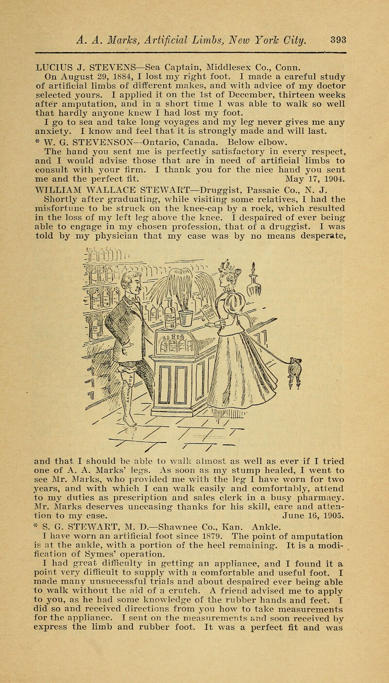 LUCIUS J. STEVENS—Sea Captain, Middlesex Co., Conn. On August 29, 1884, I lost my right foot. I made a careful study of artificial limbs of different makes, and with advice of my doctor selected yours. I applied it on the 1st of December, thirteen weeks after amputation, and in a short time I was able to walk so well that hardly anyone knew I had lost my foot. I go to sea and take long voyages and my leg never gives me any anxiety. I know and feel that it is strongly made and will last. * W. G. STEVENSON—Ontario, Canada. Below elbow. The hand you sent me is perfectly satisfactory in every respect, and I would advise those that are in need of artificial limbs to consiilt with j^our firm. I thank you for the nice hand you sent me and the perfect fit. May 17, 1904. WILLIAM WALLACE STEWART—Druggist, Passaic Co., N. J. Shortly after graduating, while visiting some relatives, I had the misfortune to be struck on the knee-cap by a rock, which resulted in the loss of my left leg above the knee. I despaired of ever being able to engage in my chosen profession, that of a druggist. I was told by my physician that my case was by no means desperate, and that I should be able to walk almost as well as ever if I tried one of A. A. Marks' legs. As soon as my stump healed, I went to see ISIr. IMai-ks, who provided me with the leg I have worn for two years, and with which I can walk easily and comfortably, attend to my duties as prescription and sales clerk in a busy pharmacy. ISFr. ]\Iarks deserves unceasing thanks for his skill, care and atten- tion to my case. June 16, 1905. * S. G. STEWAET, M. D.—Shawnee Co., Kan. Ankle. I have worn an artificial foot since 1879. The point of amputation is at the ankle, with a portion of the heel remaining. It is a modi- fication of Symes' operation. I had great ditficulty in getting an appliance, and I found it a point very difficult to supply with a comfortable and useful foot. I made many unsuccessful trials and about despaired ever being able to walk without the aid of a crutch. A friend advised me to apply to you, as he had some knowledge of the rubber hands and feet. 1 did so and received directions from you how to take measurements for the appliance. I sent on the measurements and soon received by express the limb and rubber foot. It was a perfect fit and was