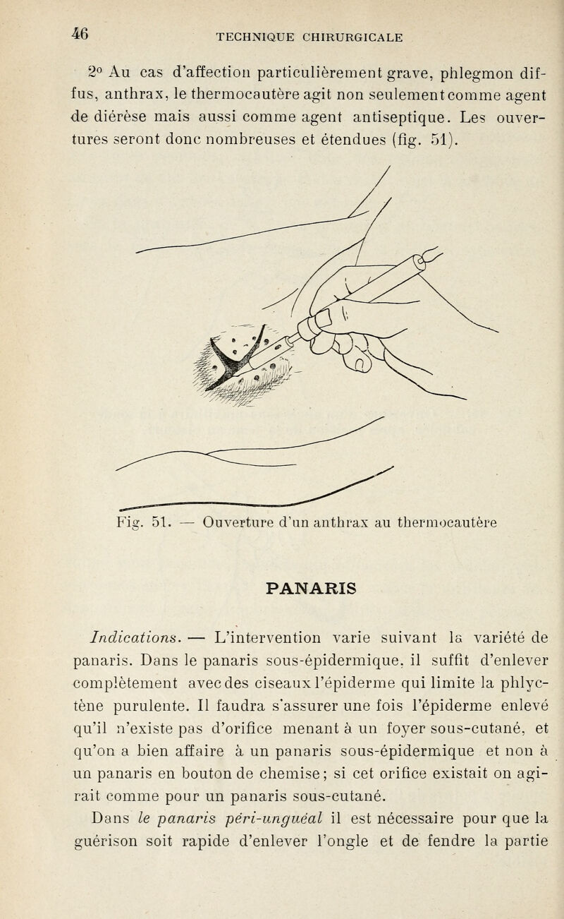 2^ Au cas d'affection particulièrement grave, phlegmon dif- fus, anthrax, le thermocautère agit non seulement comme agent de diérèse mais aussi comme agent antiseptique. Les ouver- tures seront donc nombreuses et étendues (ûg. 51). Fig. 51. Ouverture d'un anthrax au thermocautère PANARIS Indications. — L'intervention varie suivant la variété de panaris. Dans le panaris sous-épidermique, il suffit d'enlever complètement avec des ciseaux l'épiderme qui limite la phlyc- tène purulente. Il faudra s'assurer une fois l'épiderme enlevé qu'il n'existe pas d'orifice menant à un foyer sous-cutané, et qu'on a bien affaire à un panaris sous-épidermique et non à un panaris en bouton de chemise; si cet orifice existait on agi- rait comme pour un panaris sous-cutané. Dans le panaris péri-unguéal il est nécessaire pour que la guérison soit rapide d'enlever l'ongle et de fendre la partie