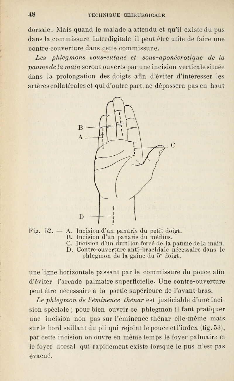 dorsale. Mais quand le malade a attendu et qu'il existe du pus dans la commissure interdigitale il peut être utile de faire une contre-couverture dans cette commissure. Les phlegmons sous-cutané et sous-aponévrotique de la paume de la main seront ouverts par une incision verticale située dans la prolongation des doigts afin d'éviter d'intéresser les artères collatérales et qui d'autre part, ne dépassera pas en haut Fio. 52. C A. Incision d'un panaris du petit doigt. B. Incision d'un panaris du médius. C. Incision d'un durillon forcé de la paume delà main. D. Contre-ouverture anti-brachiale nécessaire dans le phlegmon de la gaine du 5' doigt. une ligne horizontale passant par la commissure du pouce afin d'éviter l'arcade palmaire superficielle. Une contre-ouverture peut être nécessaire à la partie supérieure de l'avant-bras. Le phlegmon de Véminence thénar est justiciable d'une inci- sion spéciale ; pour bien ouvrir ce phlegmon il faut pratiquer une incision non pas sur l'éminence thénar elle-même mais sur le bord saillant du pli qui rejoint le pouce et l'index (fig.53), par cette incision on ouvre en même temps le foyer palmaire et le foyer dorsal qui rapidement existe lorsque le pus n'est pas évacué.