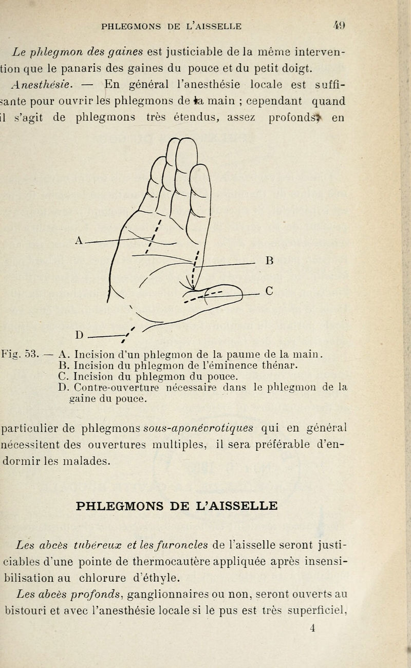 Le phlegmon des gaines est justiciable delà même interven- tion que le panaris des gaines du pouce et du petit doigt. Anesthésie. — En général l'anesthésie locale est suffi- sante pour ouvrir les phlegmons de ta main ; cependant quand il s'agit de phlegmons très étendus, assez profonds^ en Fie. 53. A. Incision d'un phlegmon de la paume de la main. B. Incision du phlegmon de l'éminence thénar. C. Incision du phlegmon du pouce. D. Contre-ouverture nécessaire dans le phlegmon de la gaine du pouce. particulier de phlegmons sous-aponévrotiques qui en général nécessitent des ouvertures multiples, il sera préférable d'en- dormir les malades. PHLEGMONS DE L'AISSELLE Les abcès tahéreux et les furoncles de l'aisselle seront justi- ciables d'une pointe de thermocautère appliquée après insensi- bilisation au chlorure d'éthyle. Les abcès profonds, ganglionnaires ou non, seront ouverts au bistouri et avec l'anesthésie locale si le pus est très superficiel, 4