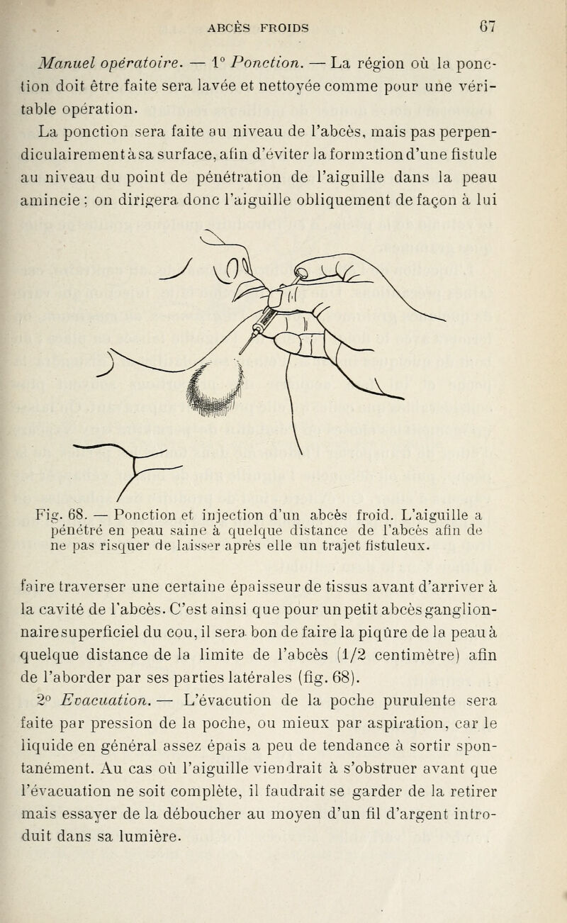 Manuel opératoire. — 1° Ponction. — La région où la ponc- tion doit être faite sera lavée et nettoyée comme pour une véri- table opération. La ponction sera faite au niveau de l'abcès, mais pas perpen- diculairement à sa surface, afin d'éviter la formation d'une fistule au niveau du point de pénétration de l'aiguille dans la peau amincie ; on diri^'era donc l'aiguille obliquement de façon à lui Fig. 68. — Ponction et injection d'un abcès froid. L'aiguille a pénétré en peau saine à quelque distance de l'abcès afin de ne pas risquer de laisser après elle un trajet fîstuleux. faire traverser une certaine épaisseur de tissus avant d'arriver à la cavité de l'abcès. C'est ainsi que pour un petit abcès ganglion- naire superficiel du cou, il sera, bonde faire la piqûre de la peau à quelque distance de la limite de l'abcès (1/2 centimètre) afin de l'aborder par ses parties latérales (fig. 68). 2° Evacuation. — L'évacution de la poche purulente sera faite par pression de la poche, ou mieux par aspiration, car le liquide en général assez épais a peu de tendance à sortir spon- tanément. Au cas où l'aiguille viendrait à s'obstruer avant que l'évacuation ne soit complète, il faudrait se garder de la retirer mais essayer de la déboucher au moyen d'un fil d'argent intro- duit dans sa lumière.