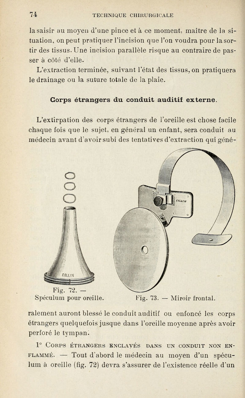 la saisir au moyen d'une pince et à ce moment, maître de la si- tuation, on peut pratiquer l'incision que l'on voudra pour la sor- tir des tissus. Une incision parallèle risque au contraire de pas- ser à côté d'elle. L'extraction terminée, suivant l'état des tissus, on pratiquera le drainage ou la suture totale de la plaie. Corps étrangers du conduit auditif externe. L'extirpation des corps étrangers de l'oreille est chose facile chaque fois que le sujet, en général un enfant, sera conduit au médecin avant d'avoir subi des tentatives d'extraction qui géné- Fig. 72. - Spéculum pour oreille. Fig. 73. — Miroir frontal. ralement auront blessé le conduit auditif ou enfoncé les corps étrangers quelquefois jusque dans l'oreille moyenne après avoir perforé le tympan. 1° Corps étrangers enclaves dans un conduit non en- flammé. — Tout d'abord le médecin au moyen d'un spécu- lum à oreille (fig. 72) devra s'assurer de l'existence réelle d'un